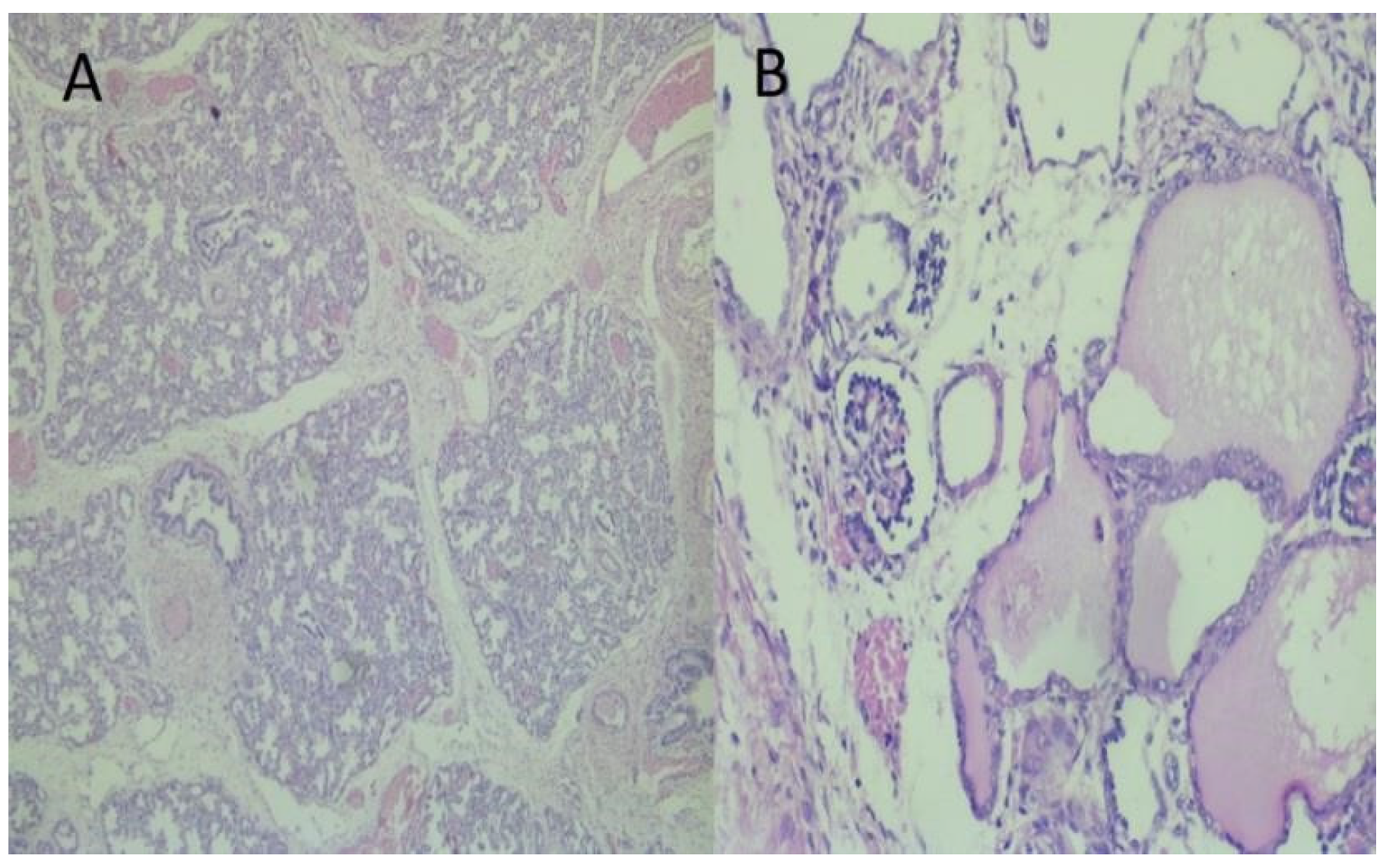Medicina 56 00109 g003