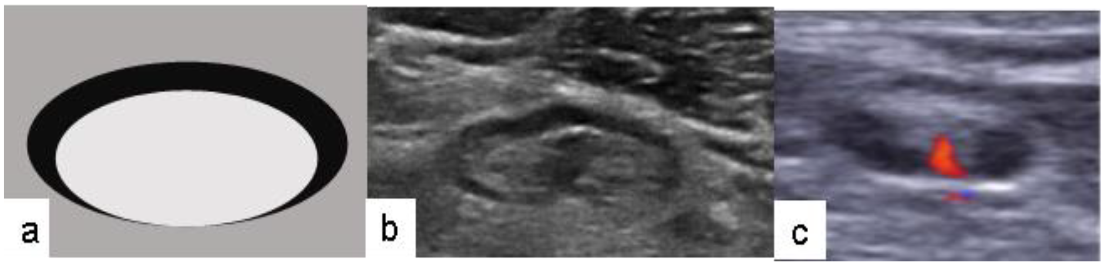 Medicina 56 00127 g001