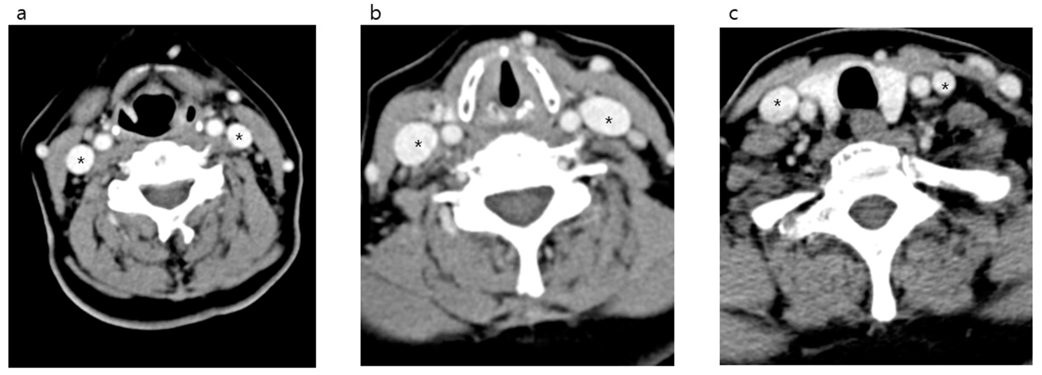 Medicina 56 00135 g002