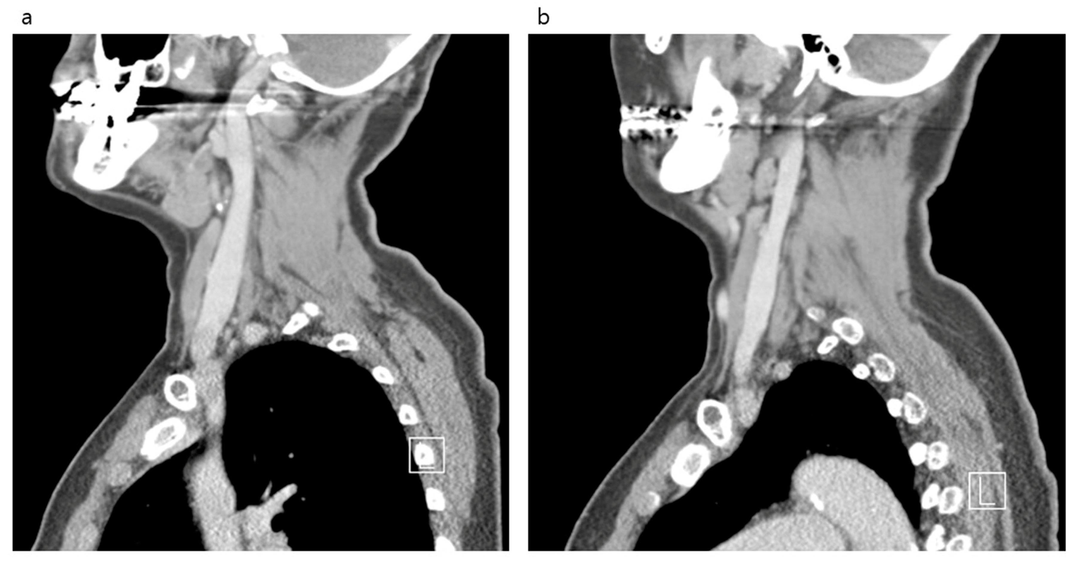 Medicina 56 00135 g003