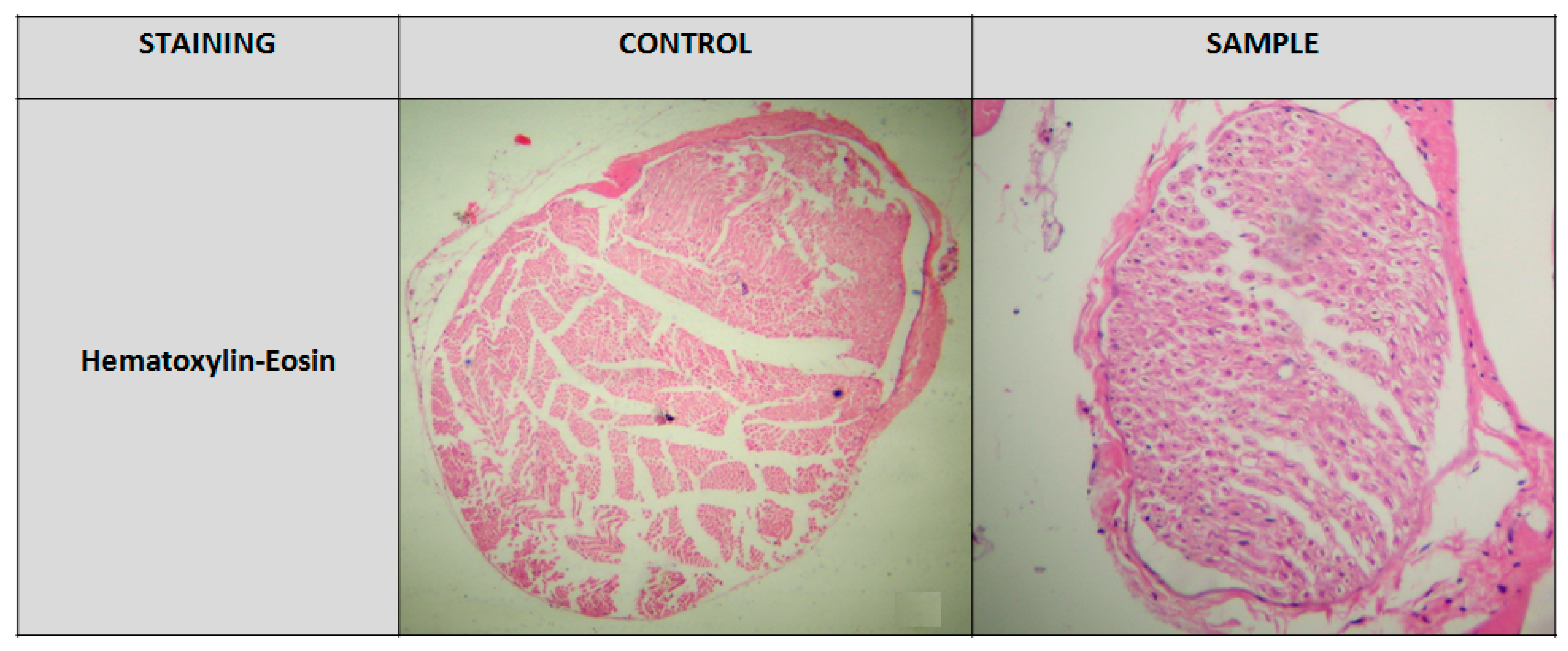 Medicina 56 00140 g004