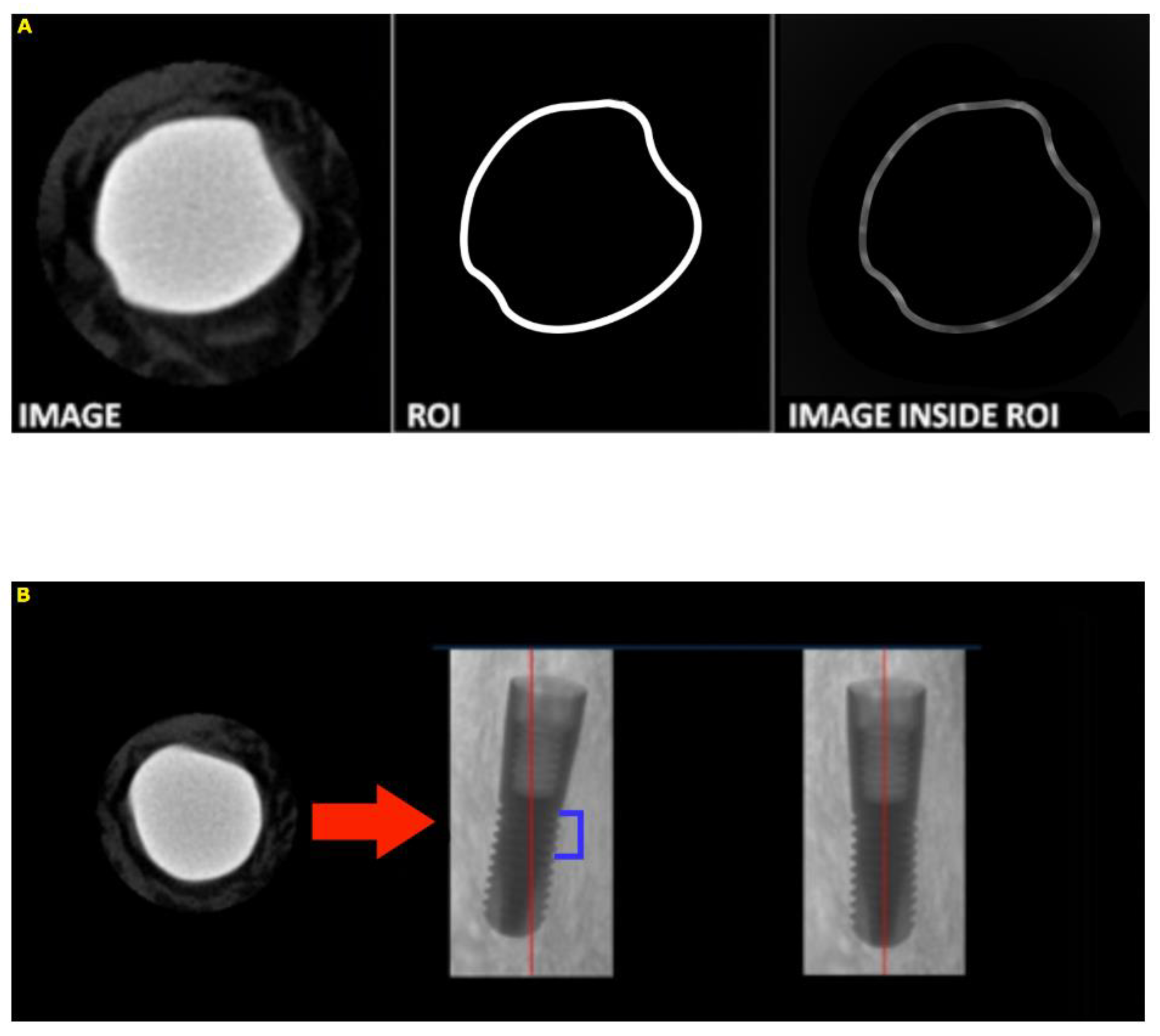 Medicina 56 00148 g002 Medicina 56 00148 g002