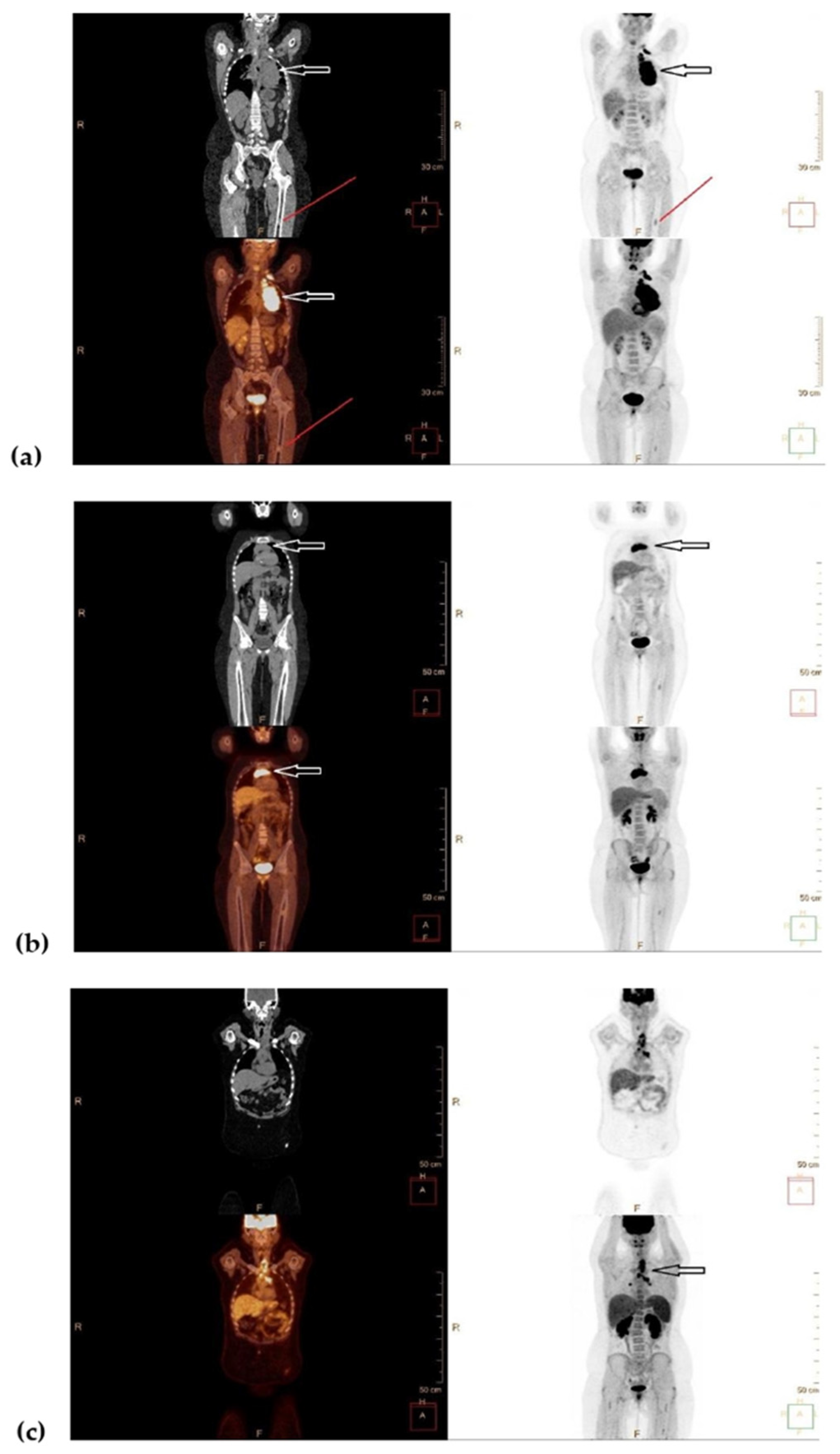 Medicina 56 00155 g001 Medicina 56 00155 g001