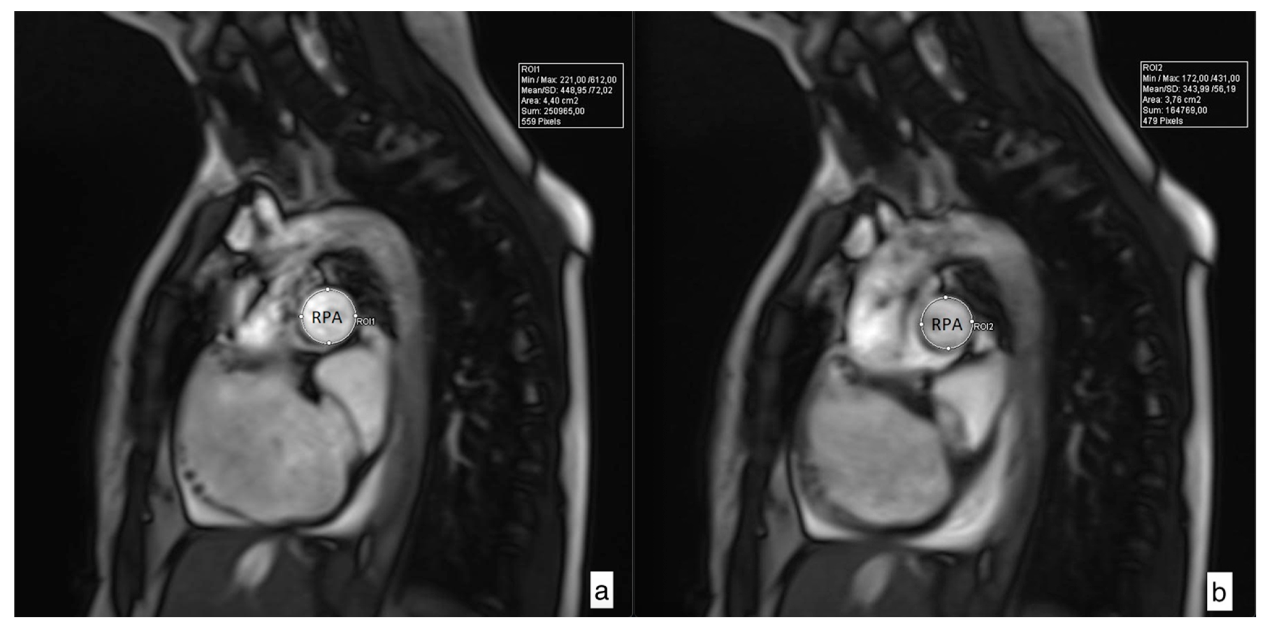Medicina 56 00167 g002 Medicina 56 00167 g002
