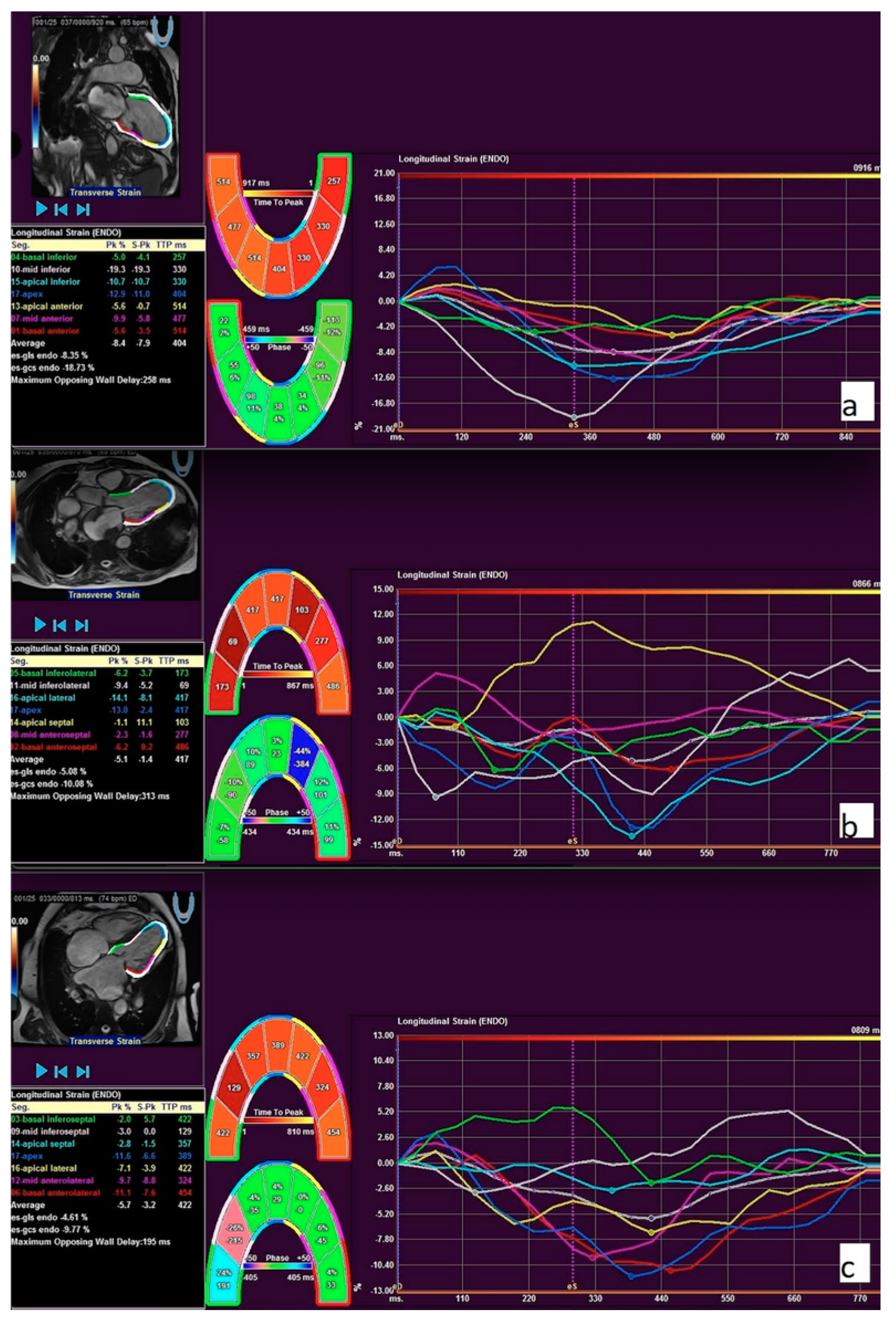 Medicina 56 00167 g003 Medicina 56 00167 g003