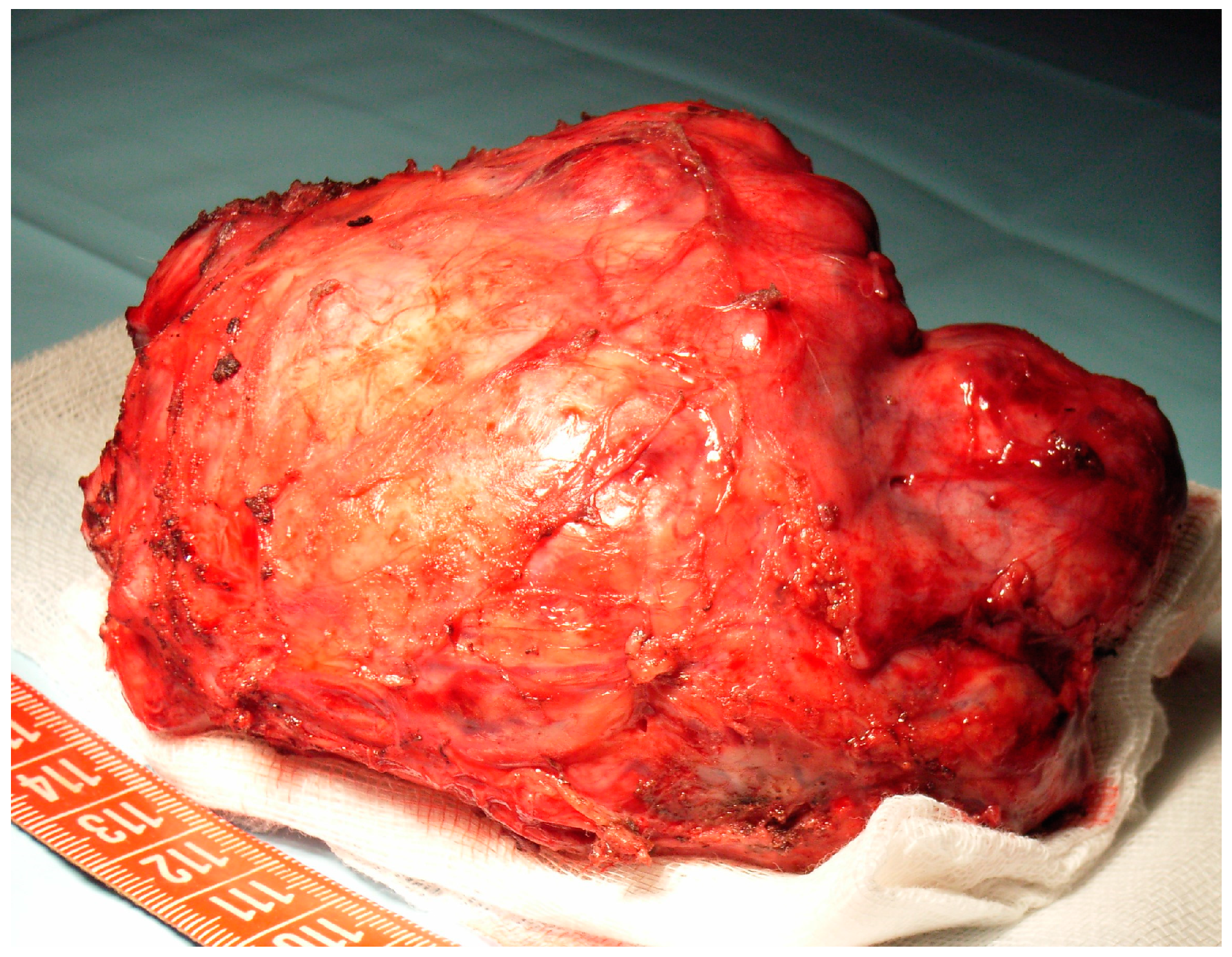 Medicina 56 00185 g001 Medicina 56 00185 g001