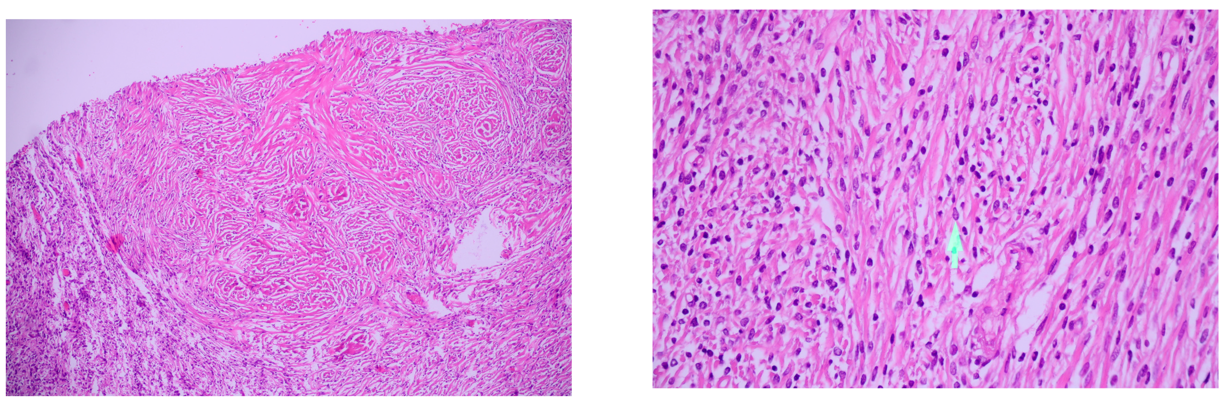 Medicina 56 00185 g003 Medicina 56 00185 g003