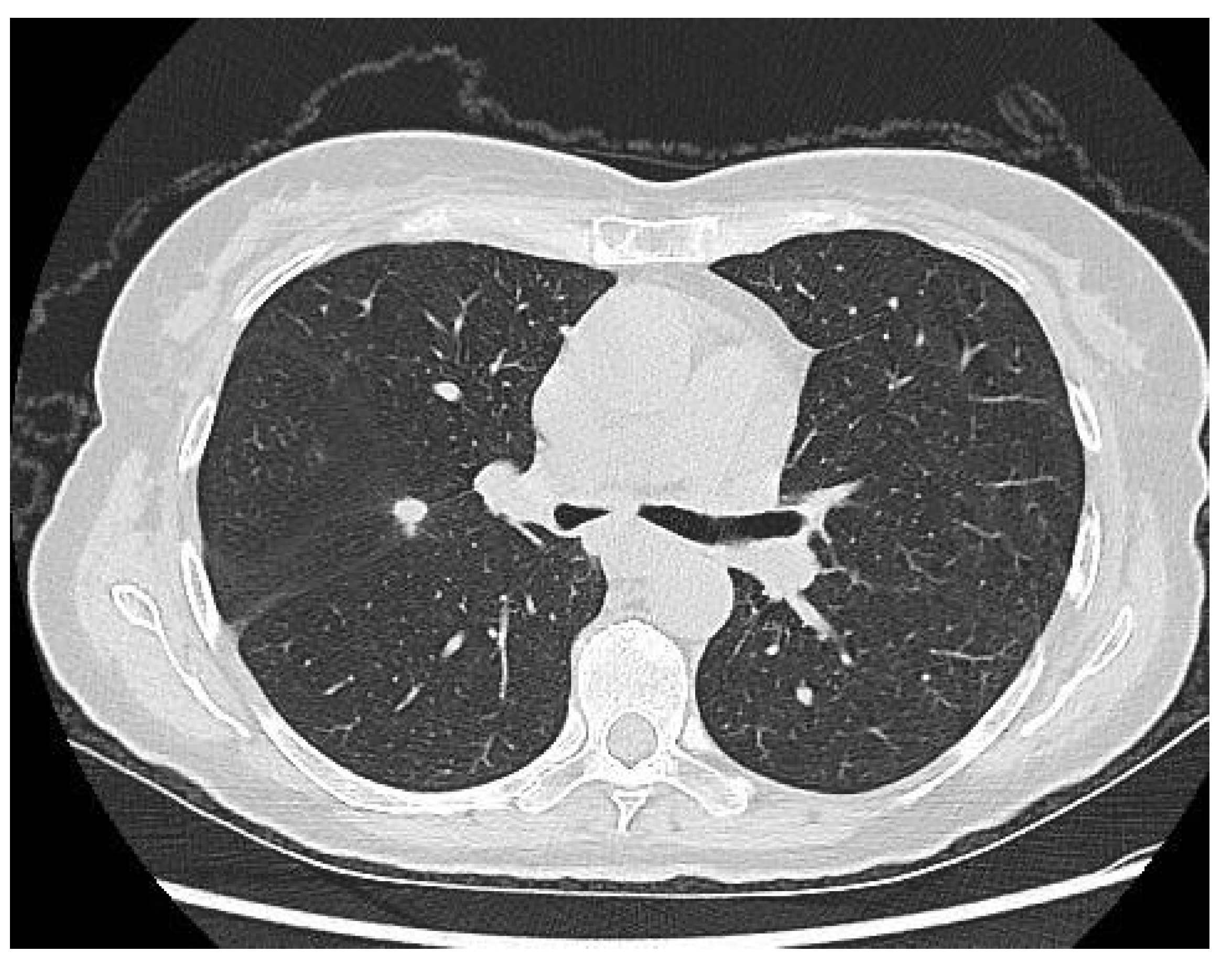 Medicina 56 00187 g003