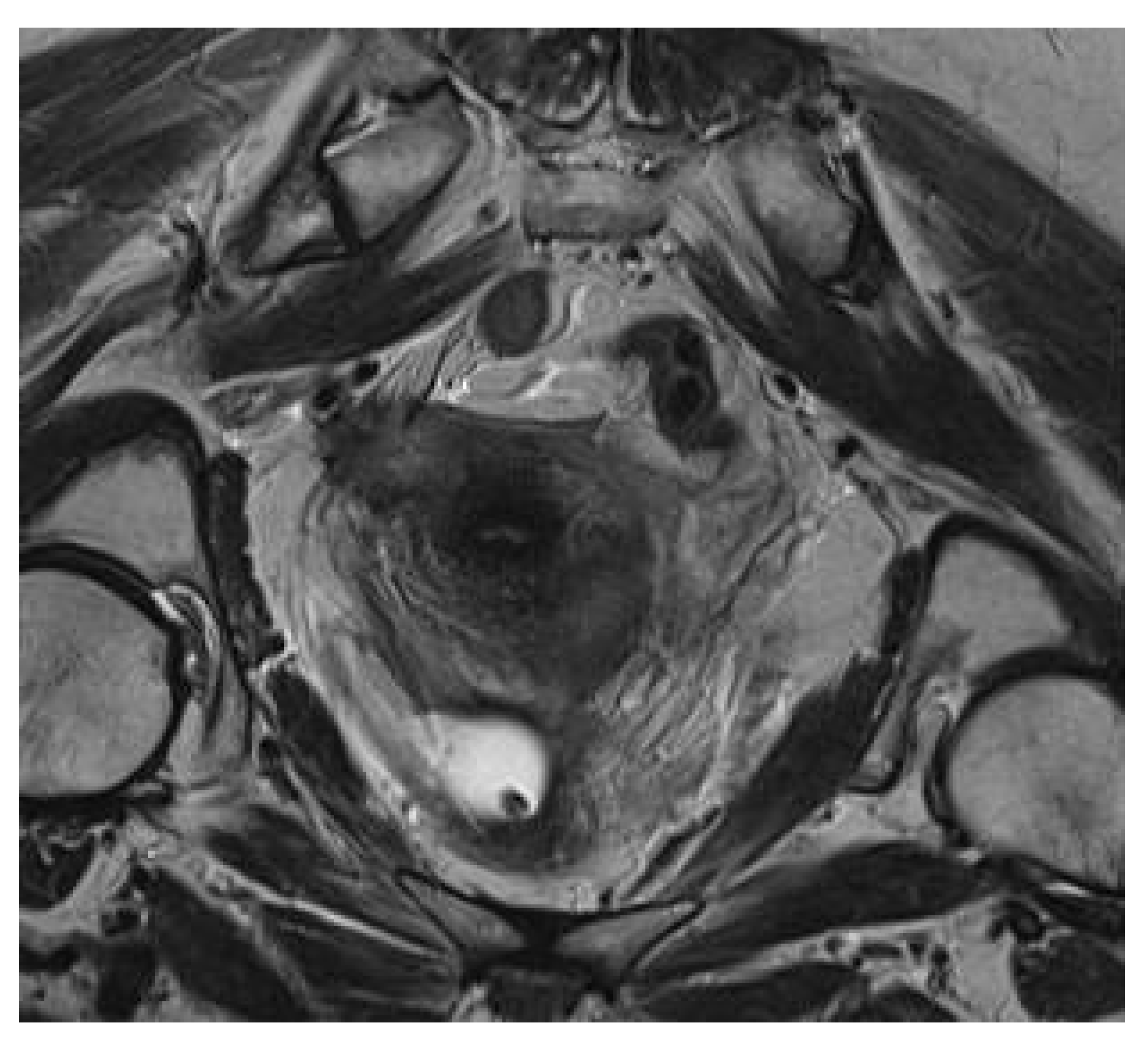 Medicina 56 00187 g004