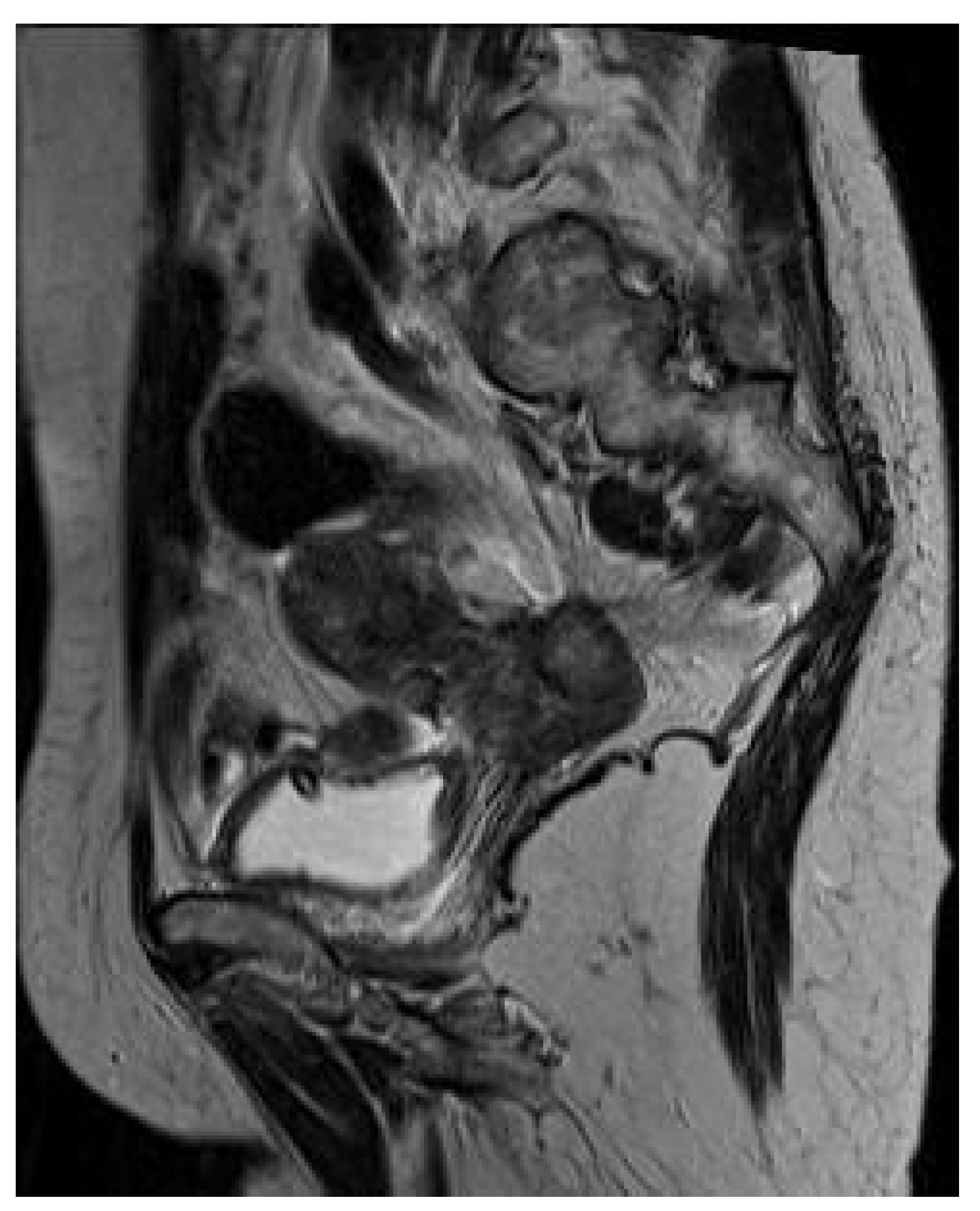 Medicina 56 00187 g005