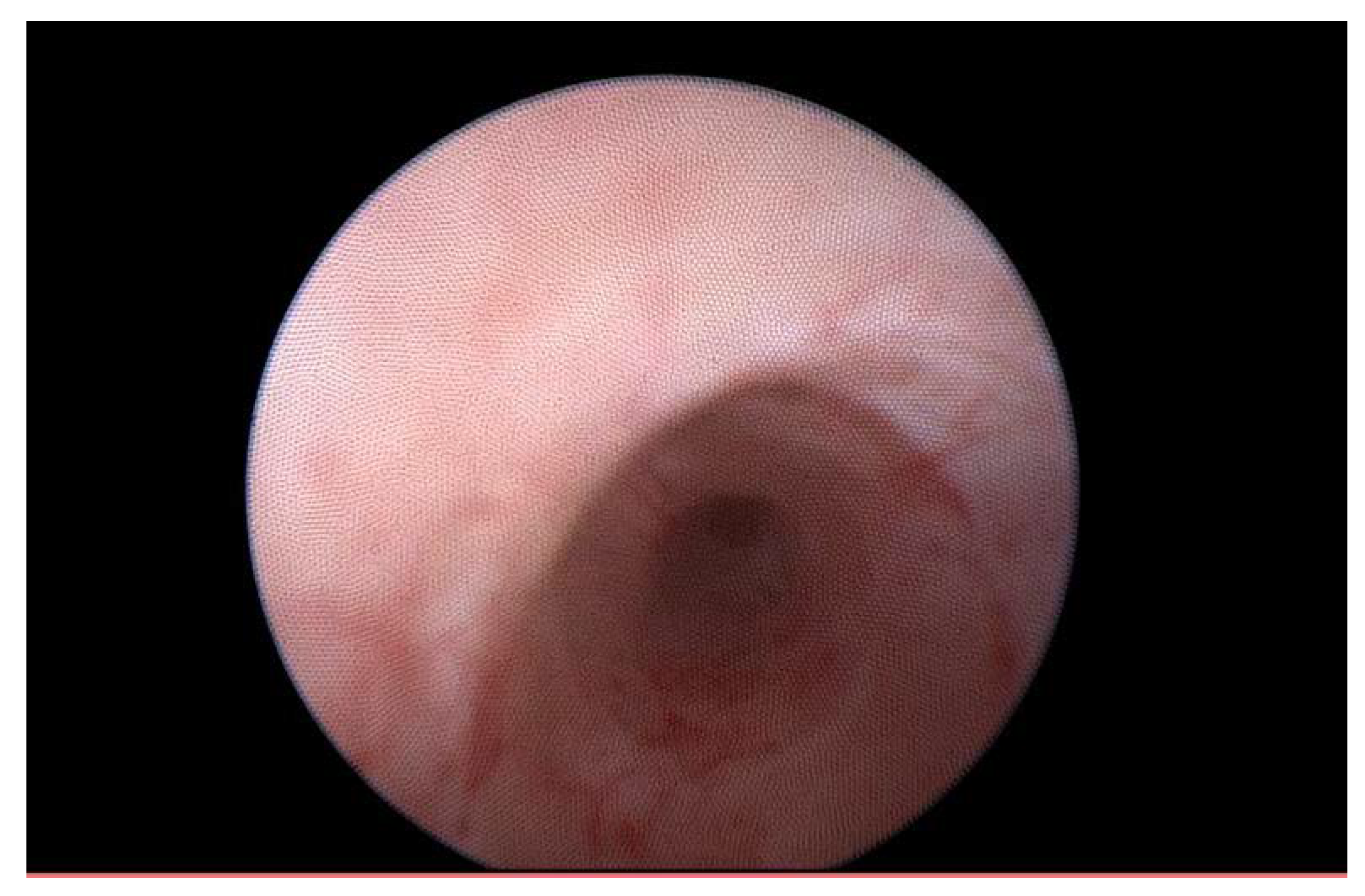 Medicina 56 00187 g006