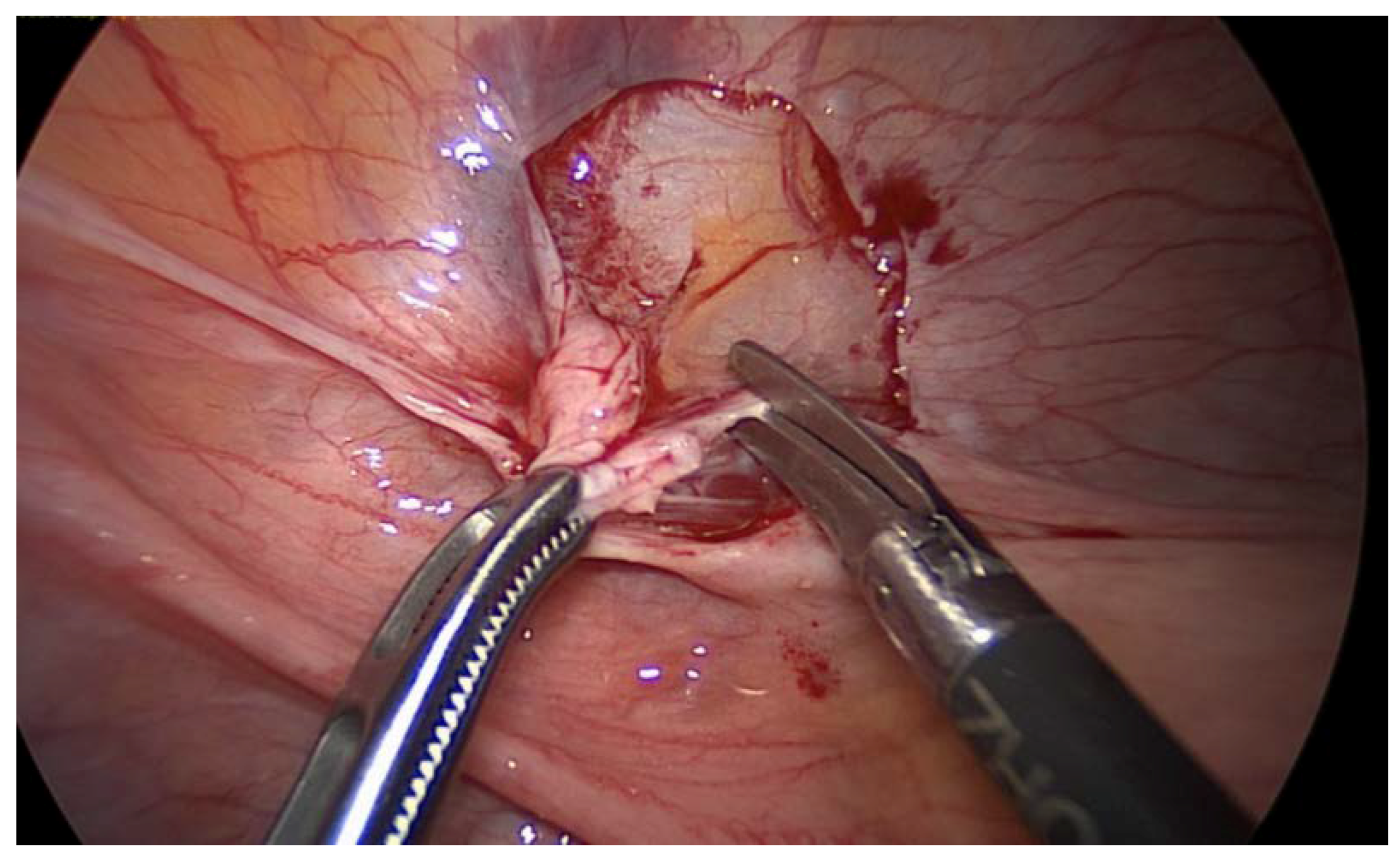 Medicina 56 00187 g009