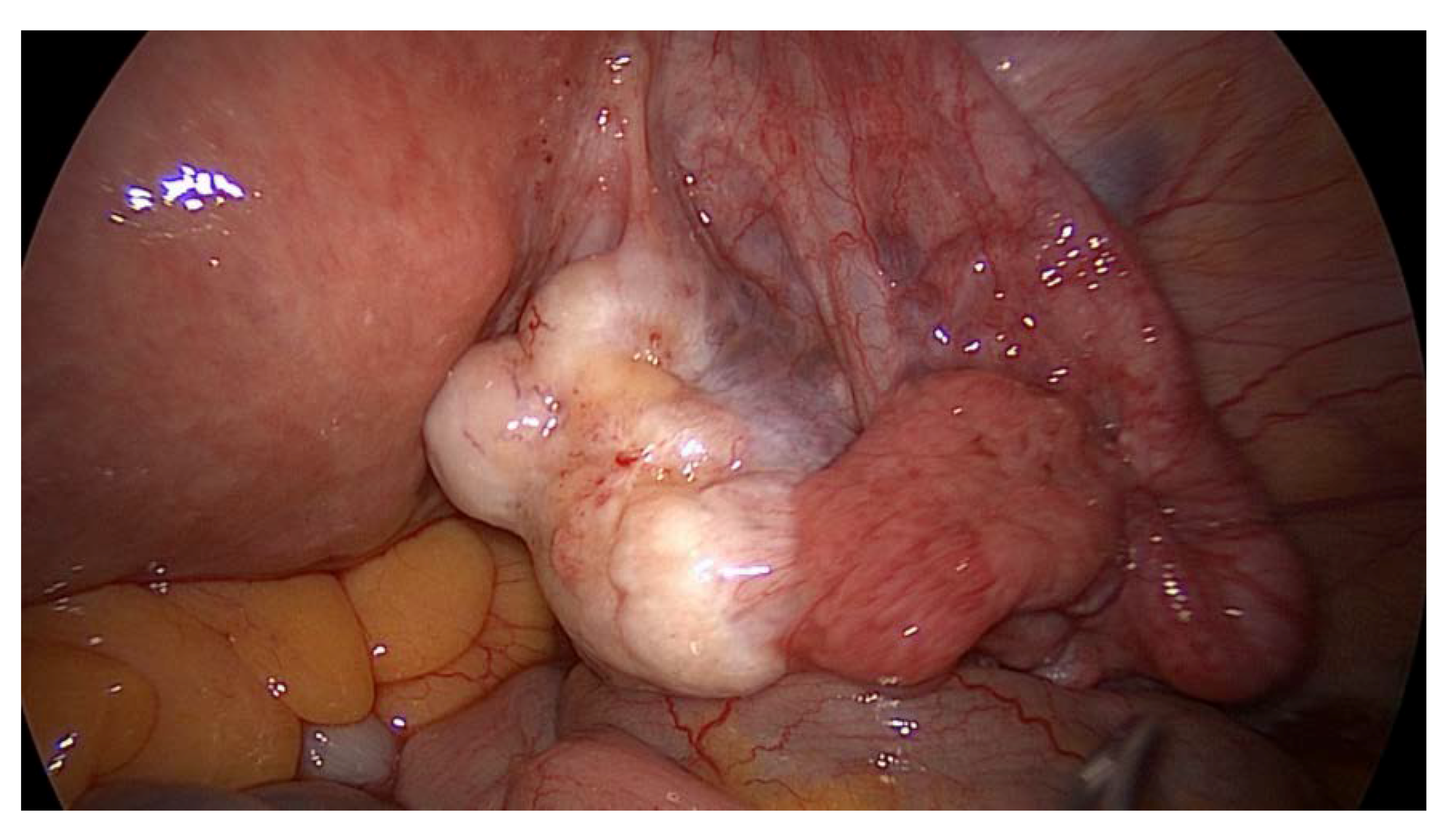 Medicina 56 00187 g010