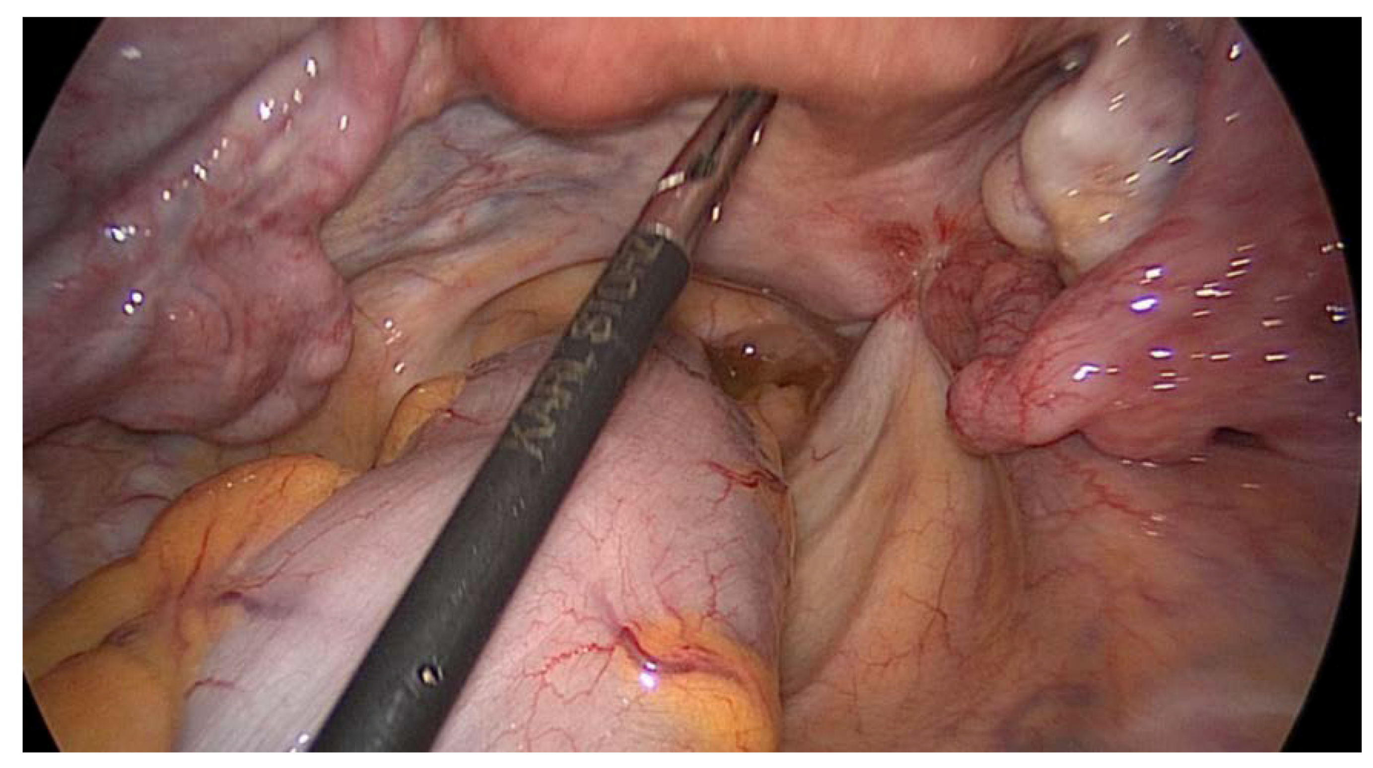 Medicina 56 00187 g011