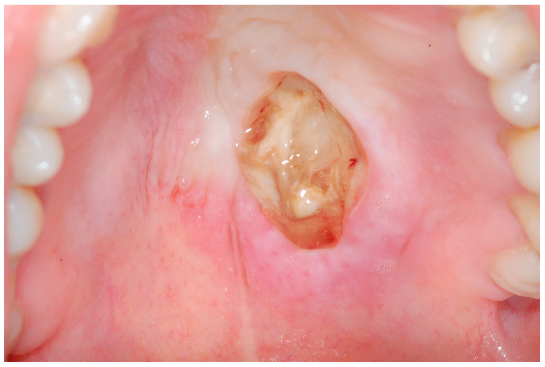 Medicina 56 00188 g001