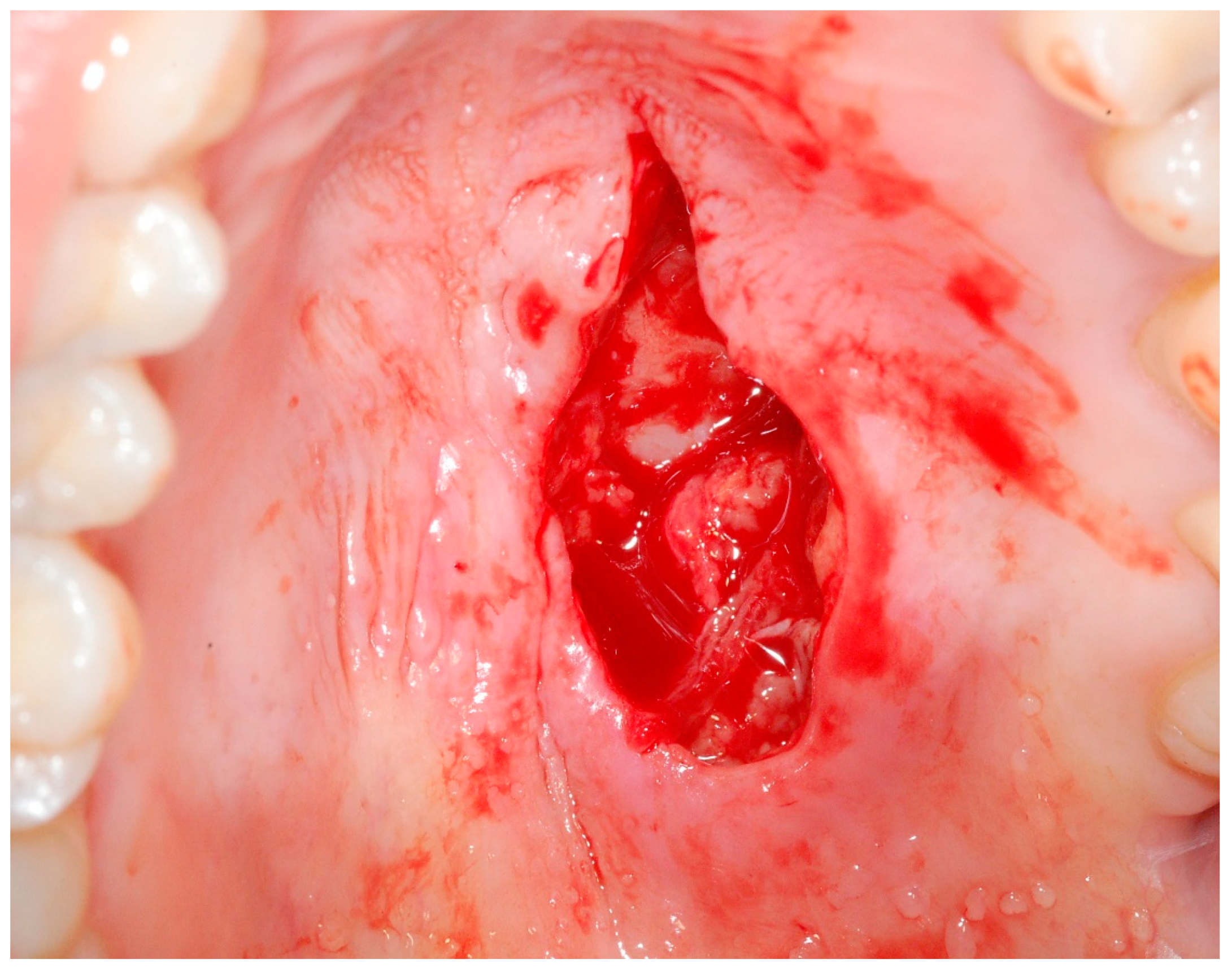 Medicina 56 00188 g002