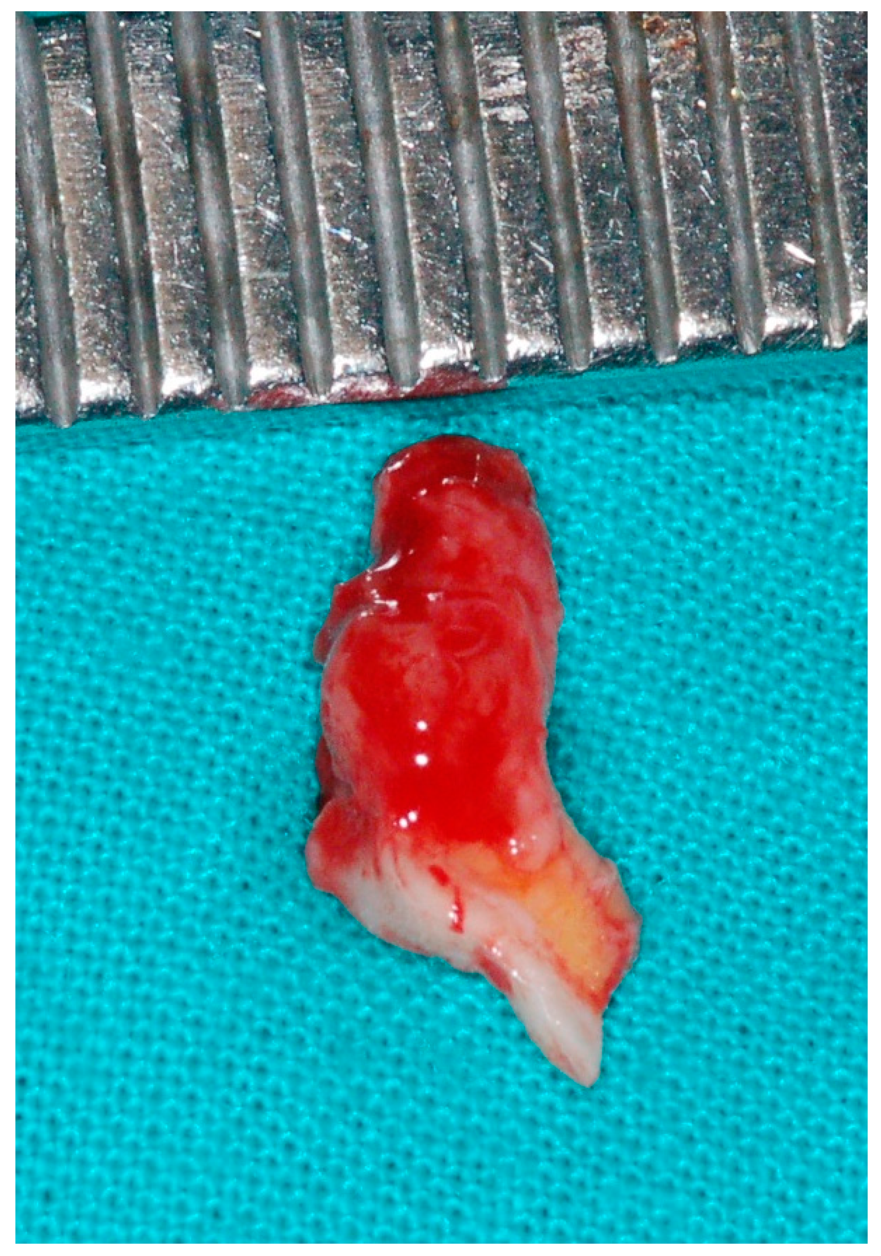 Medicina 56 00188 g003