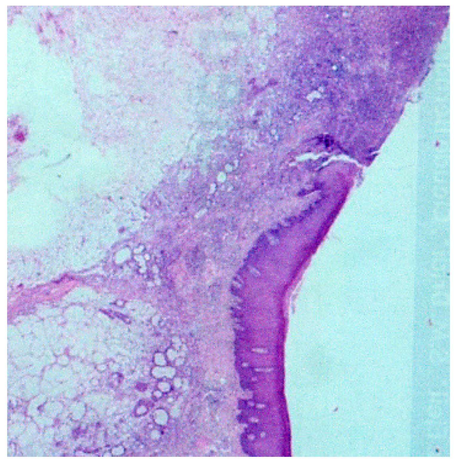 Medicina 56 00188 g004