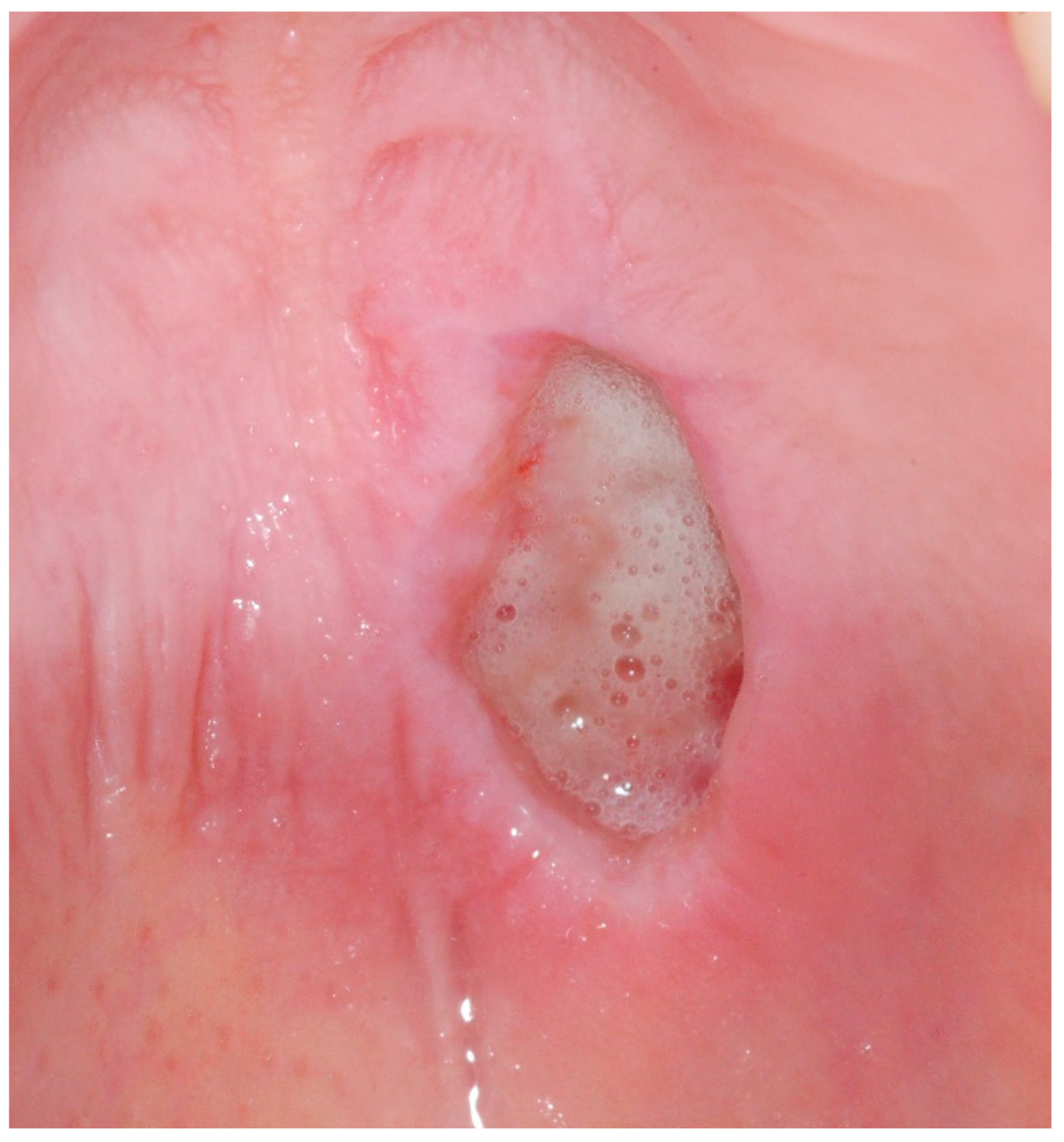 Medicina 56 00188 g006