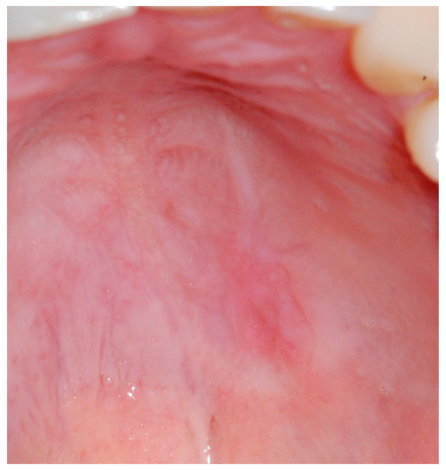 Medicina 56 00188 g007