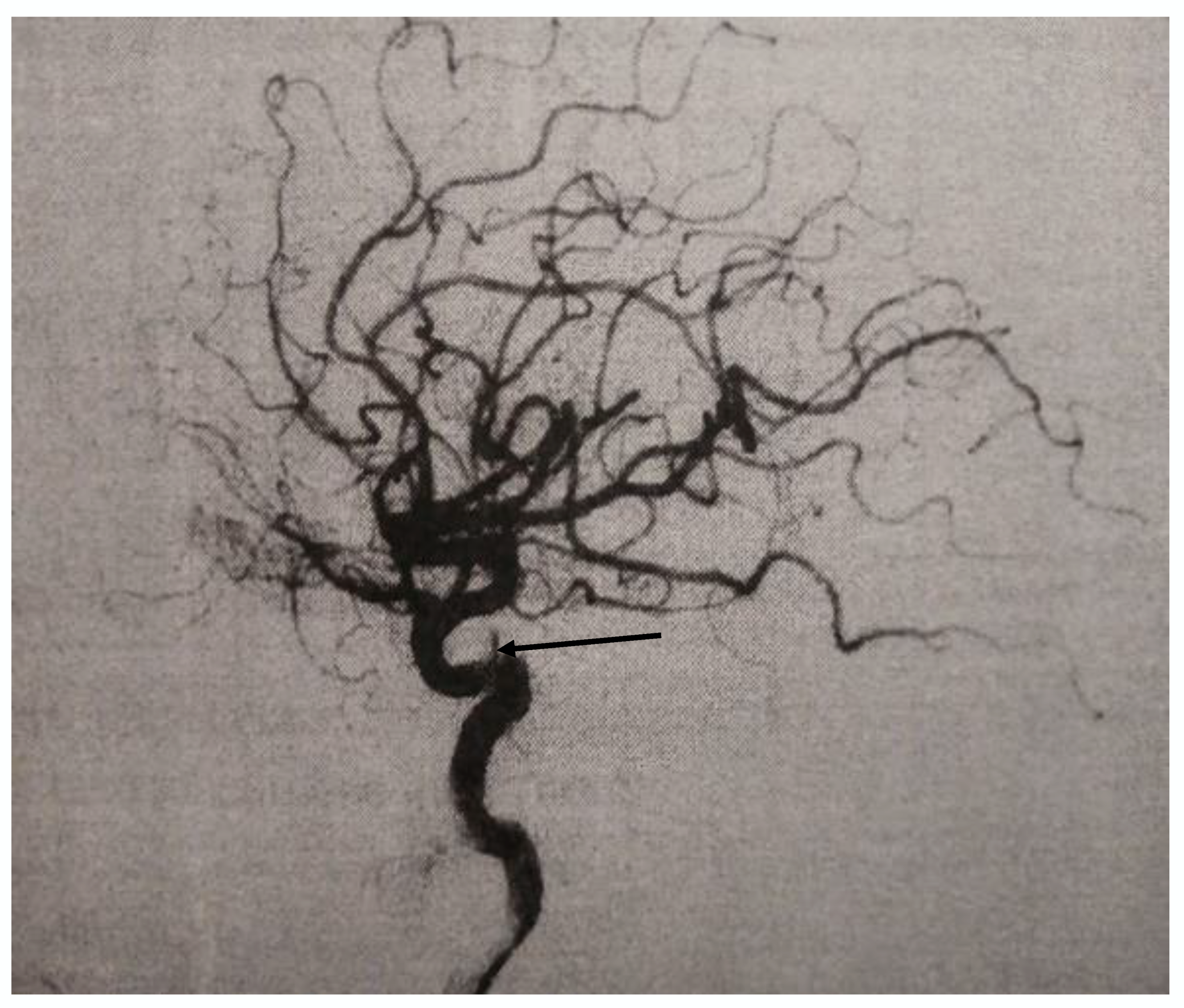 Medicina 56 00194 g002