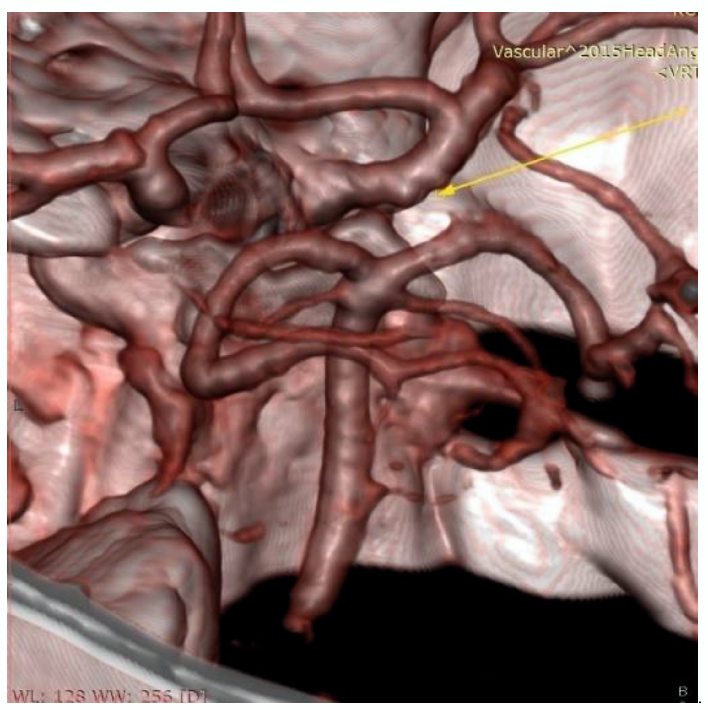 Medicina 56 00194 g003
