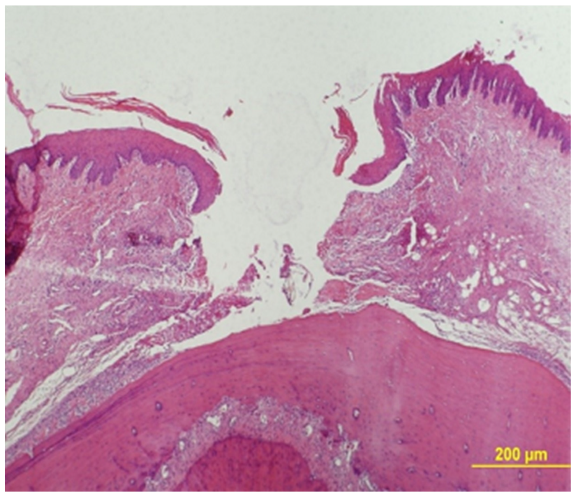 Medicina 56 00200 g003
