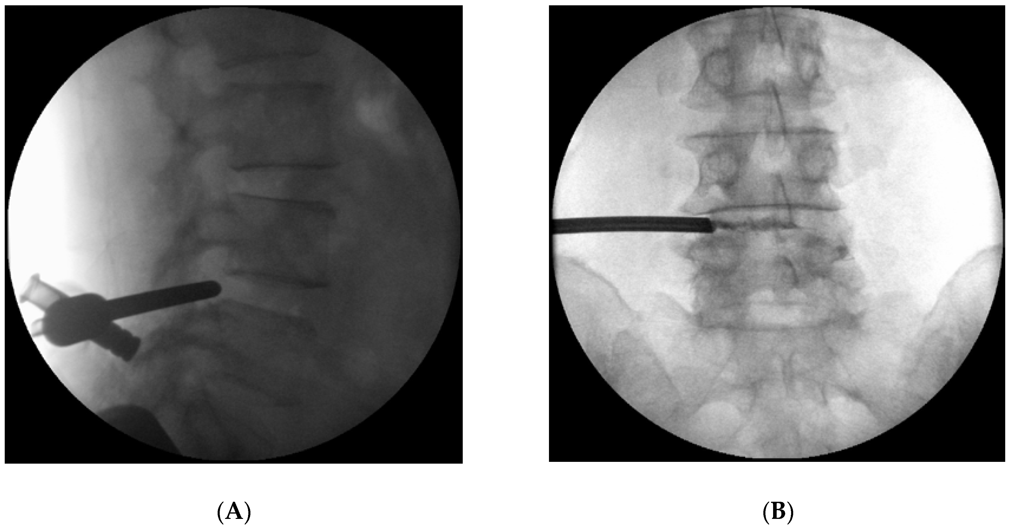 Medicina 56 00209 g002 Medicina 56 00209 g002
