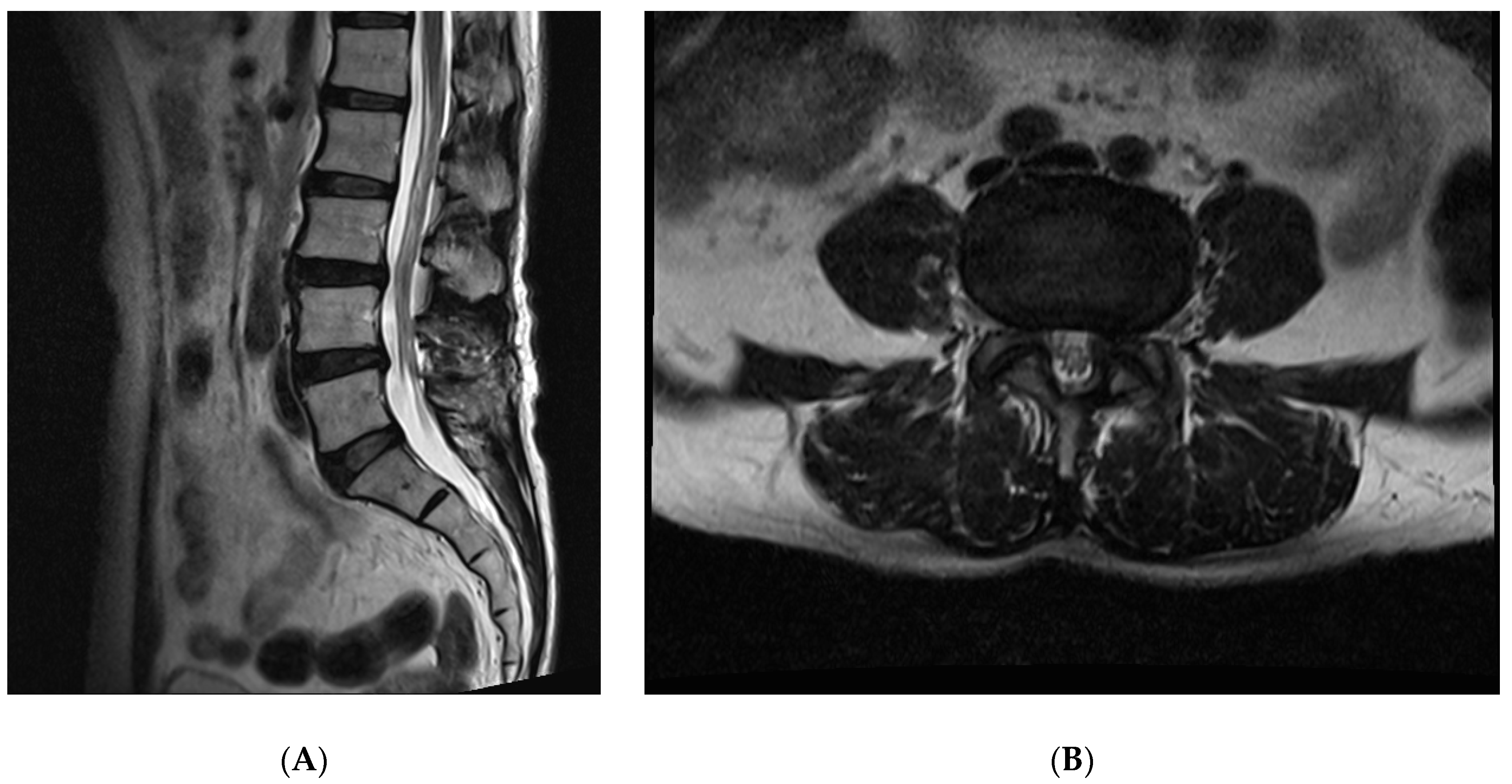 Medicina 56 00209 g003 Medicina 56 00209 g003