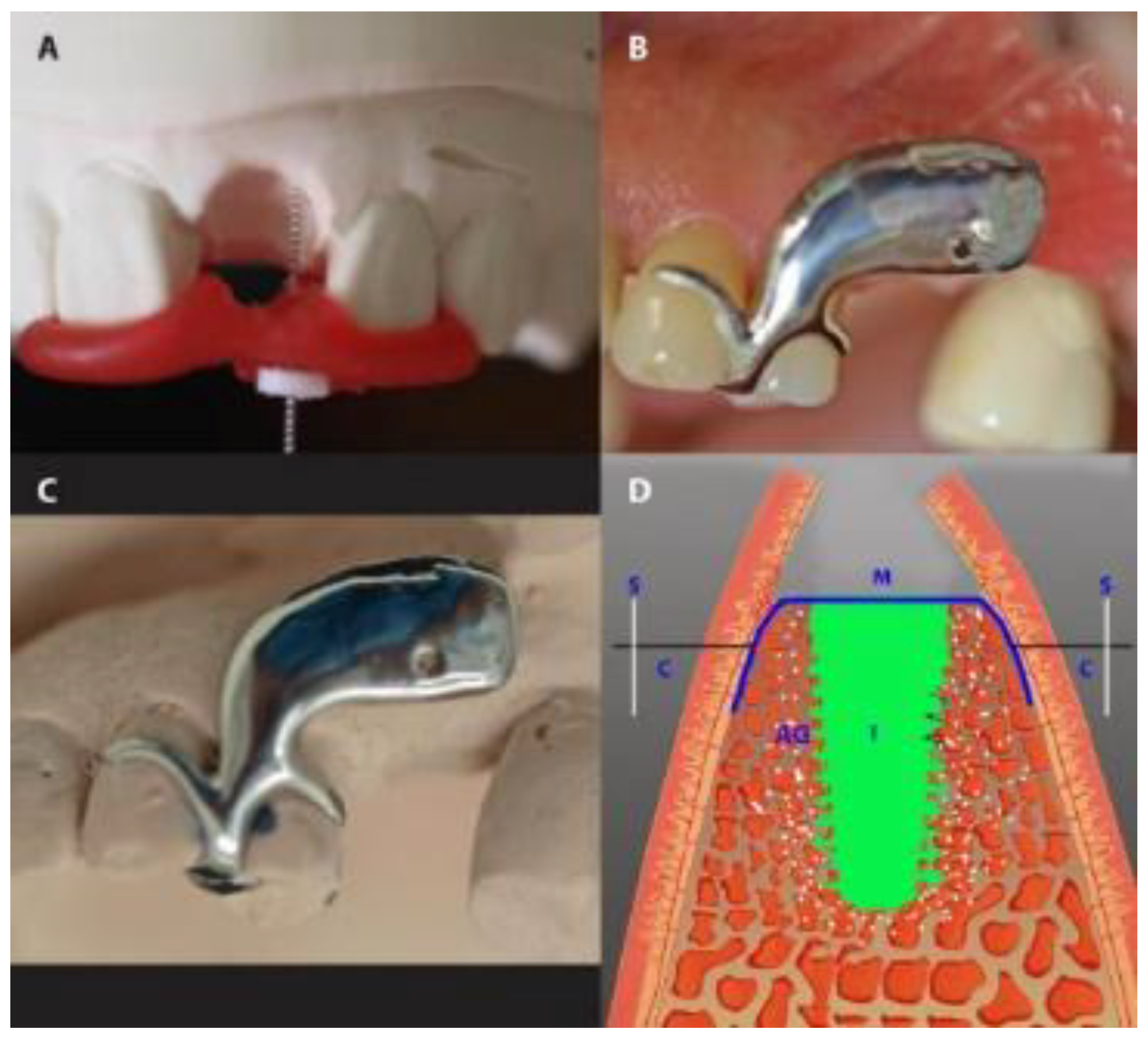 Medicina 56 00216 g004