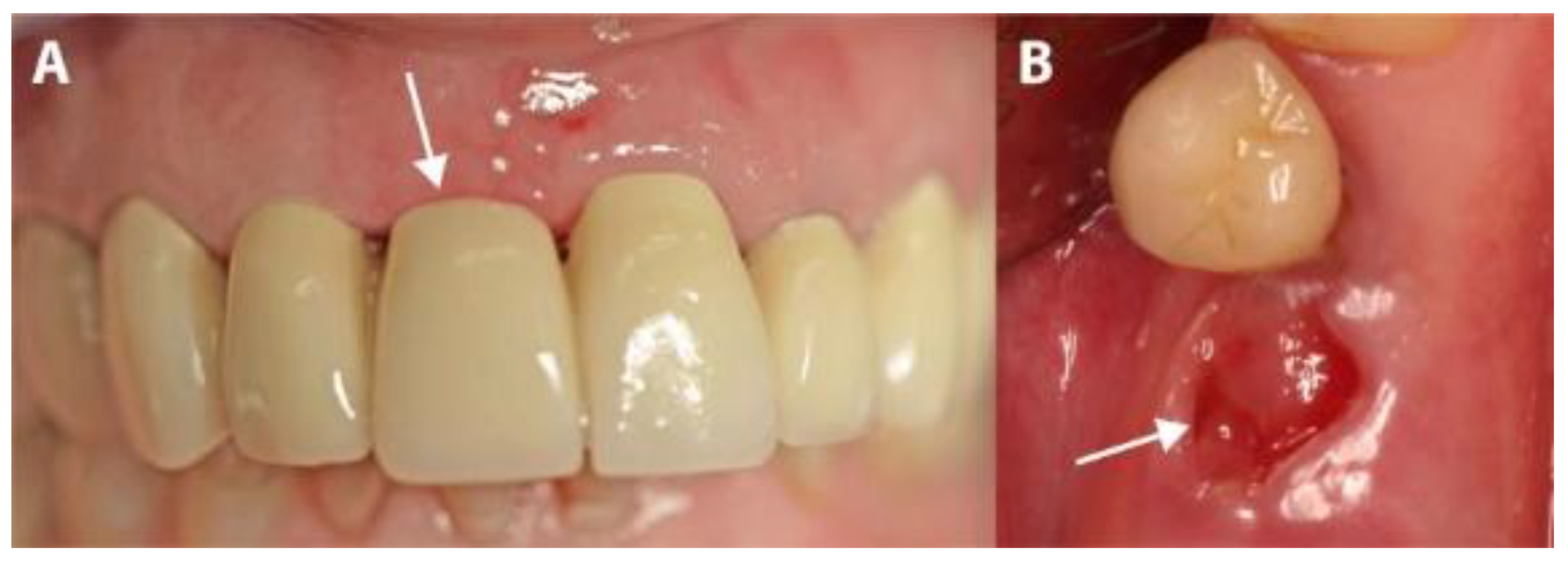 Medicina 56 00216 g006