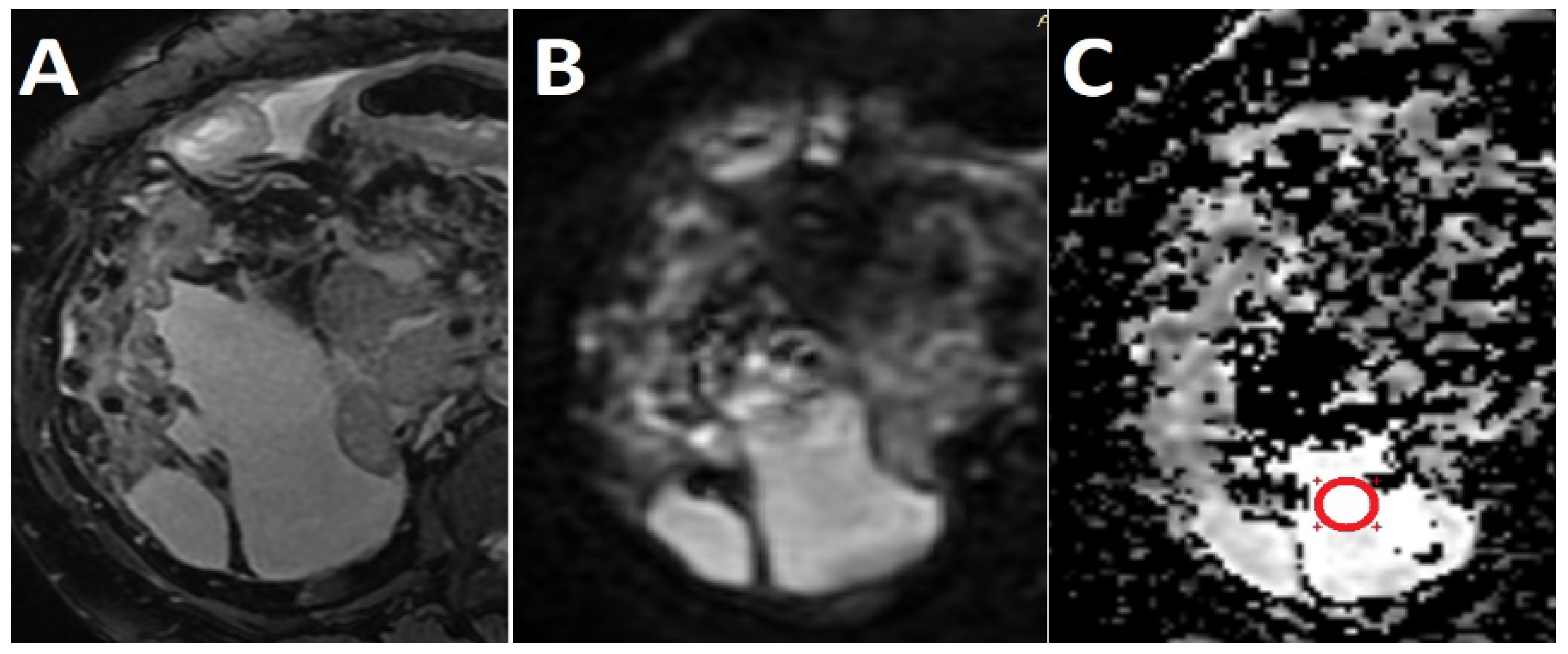 Medicina 56 00217 g002