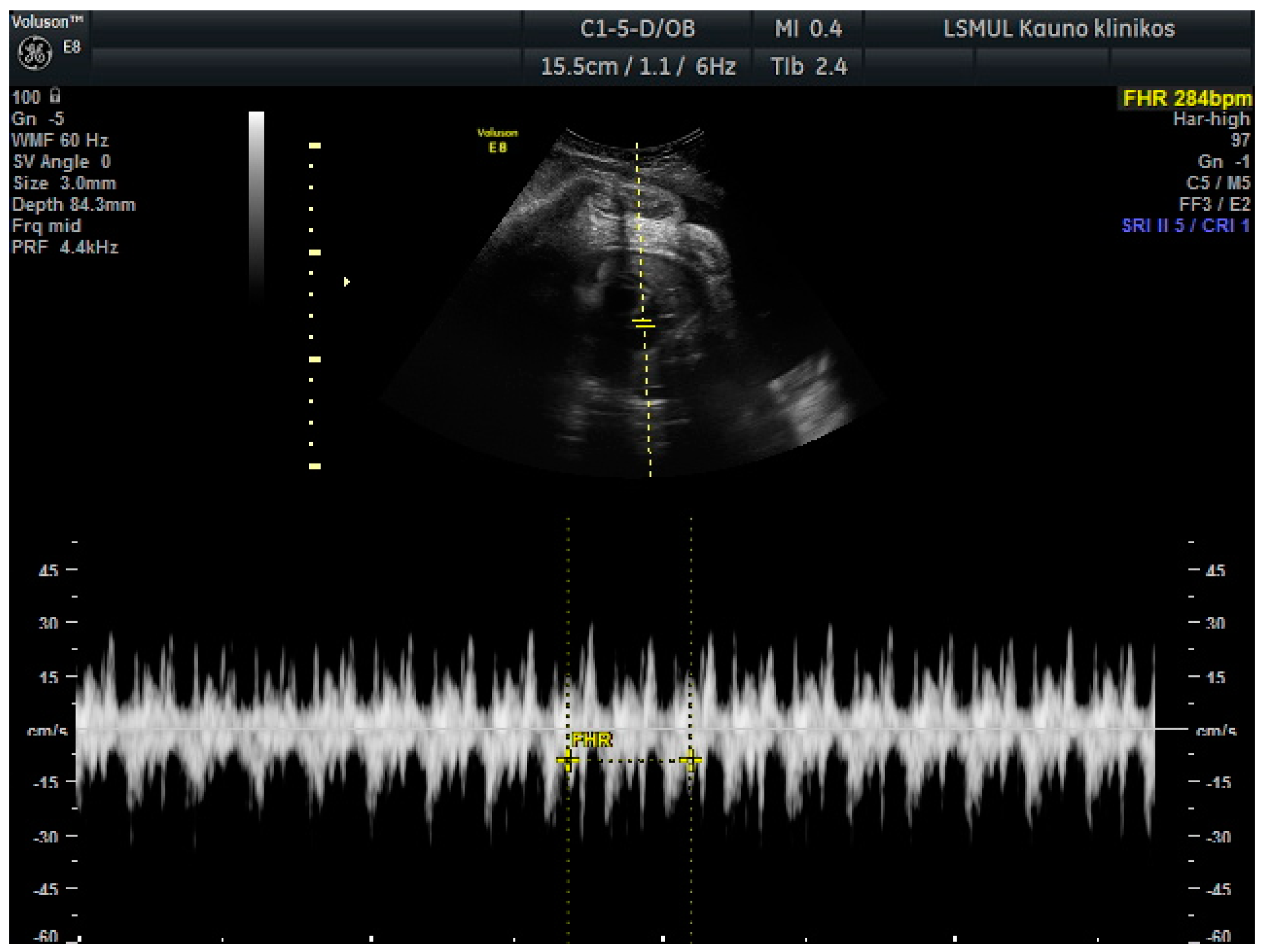 Medicina 56 00223 g001