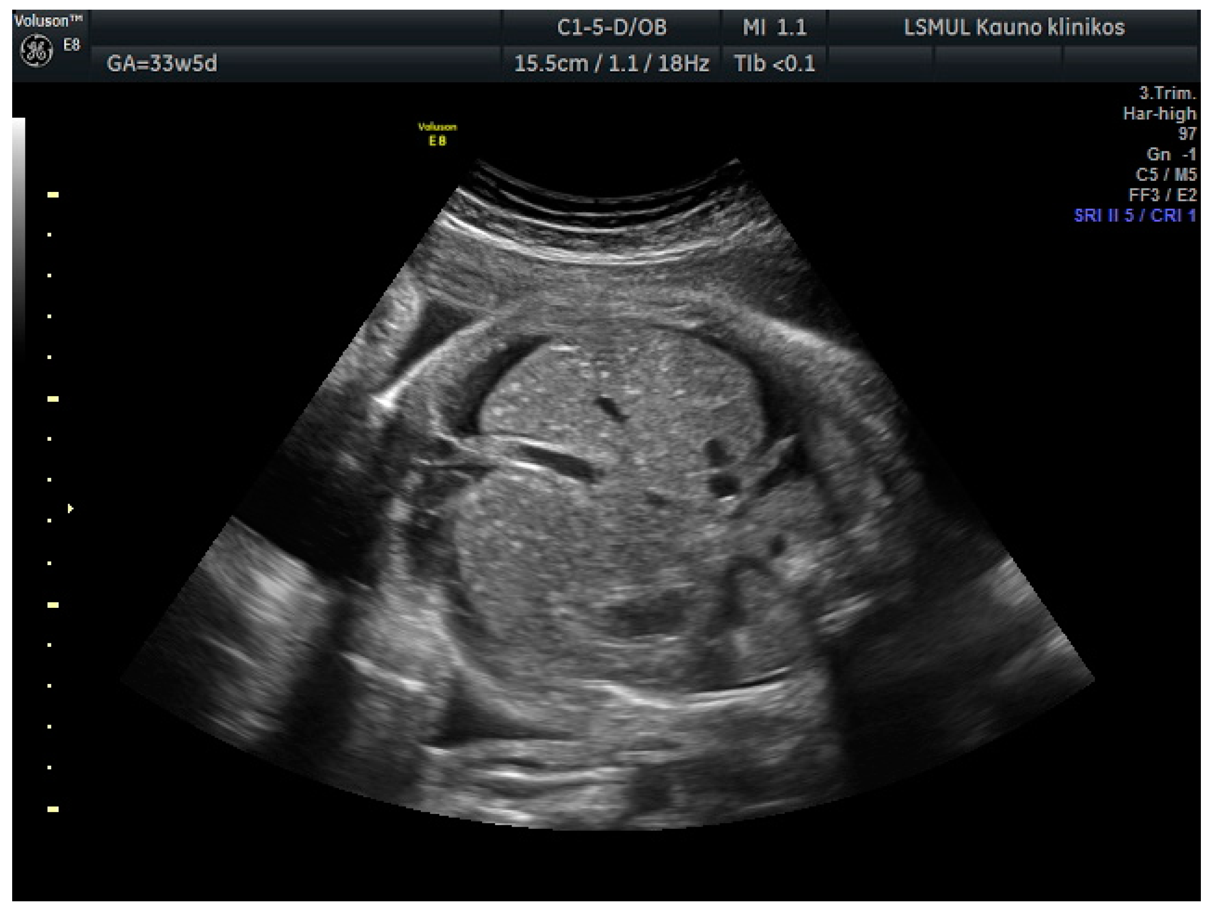 Medicina 56 00223 g002