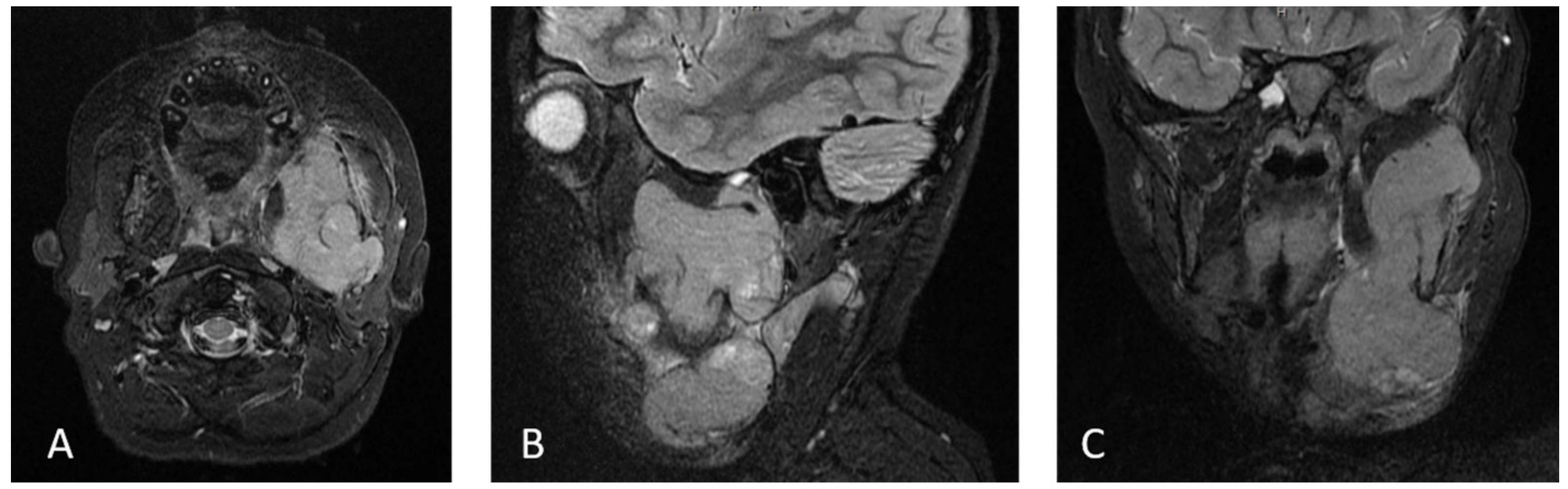 Medicina 56 00224 g002