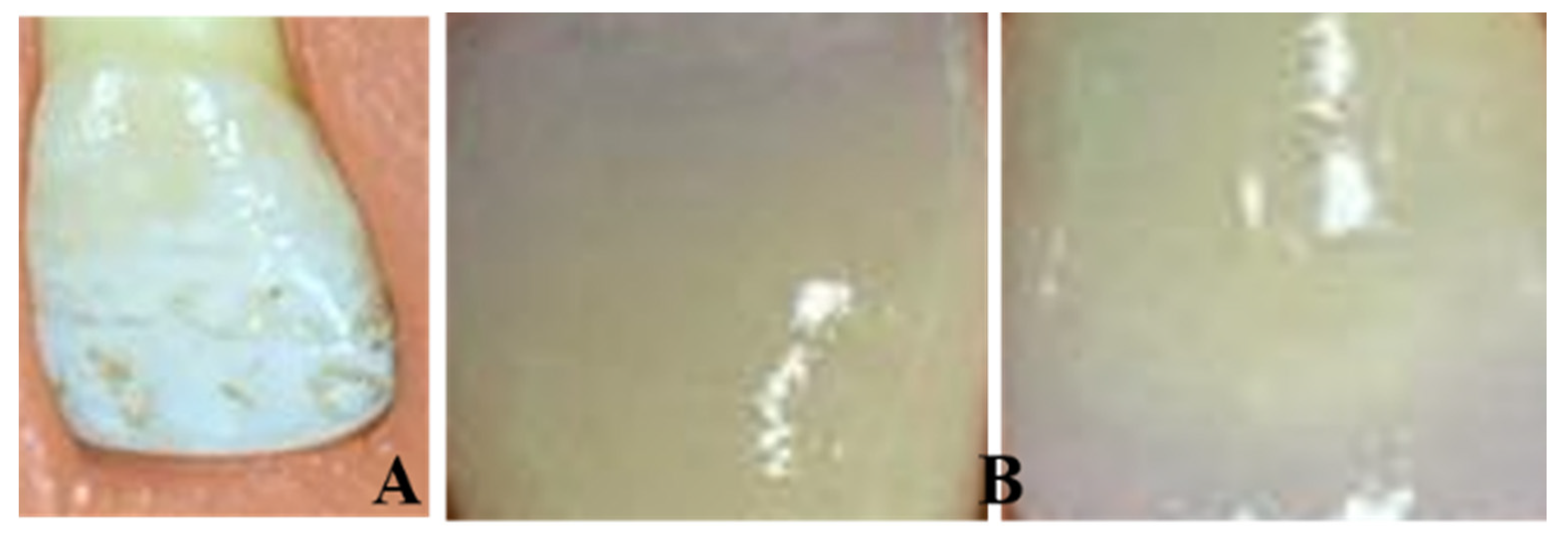 Medicina 56 00234 g001