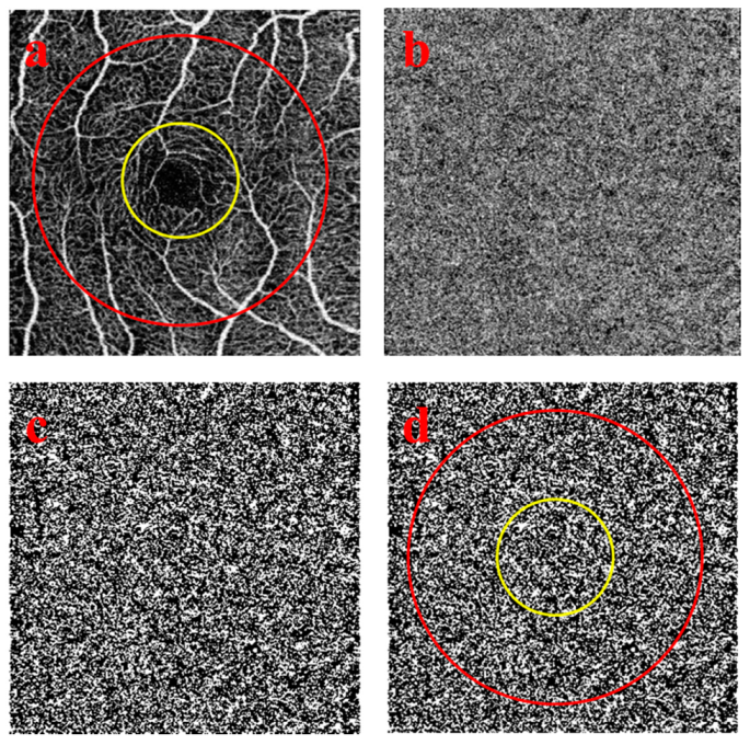 Medicina 56 00238 g001