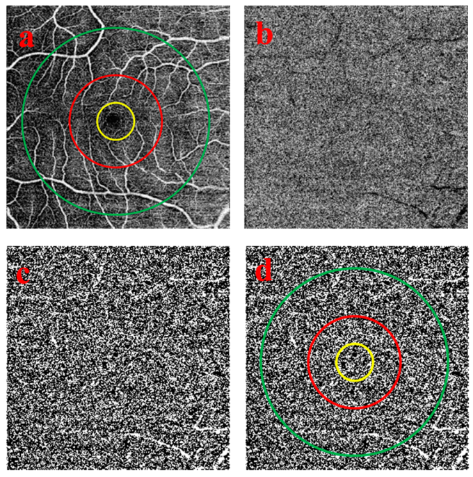 Medicina 56 00238 g002