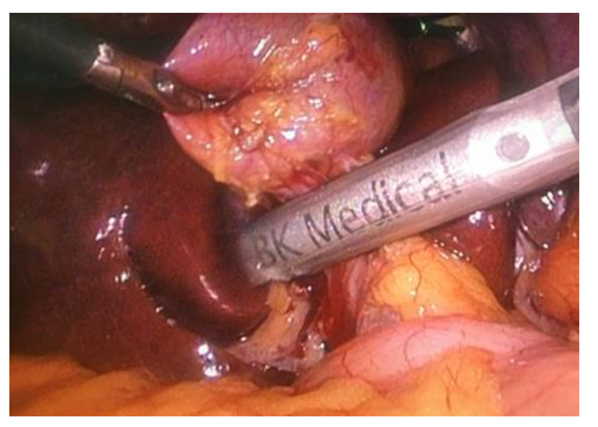 Medicina 56 00246 g001