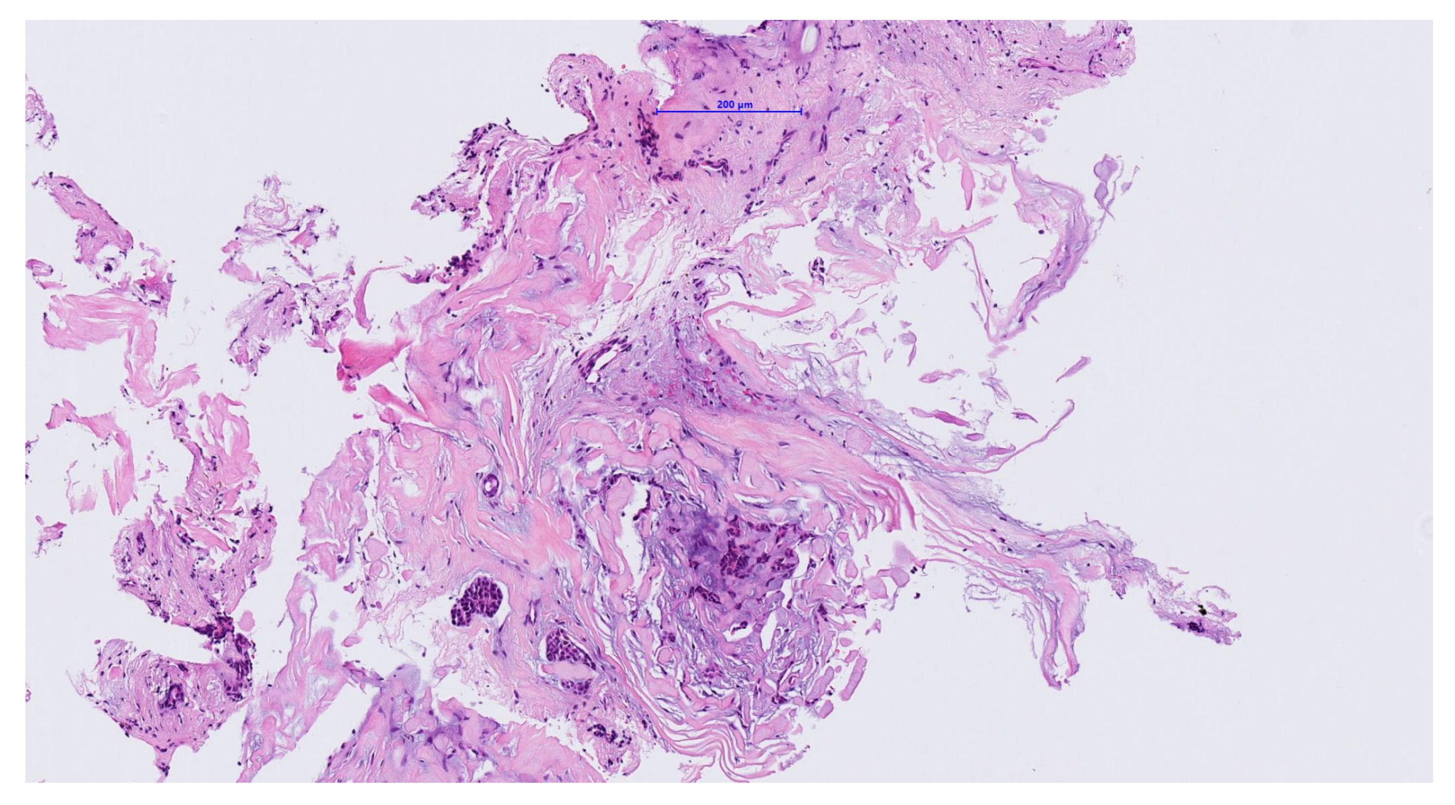 Medicina 56 00248 g003 Medicina 56 00248 g003
