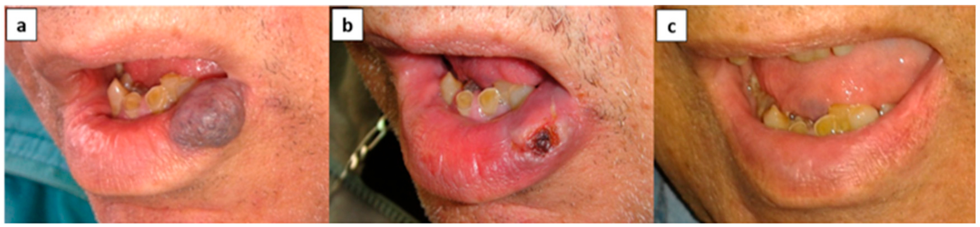 Medicina 56 00254 g001