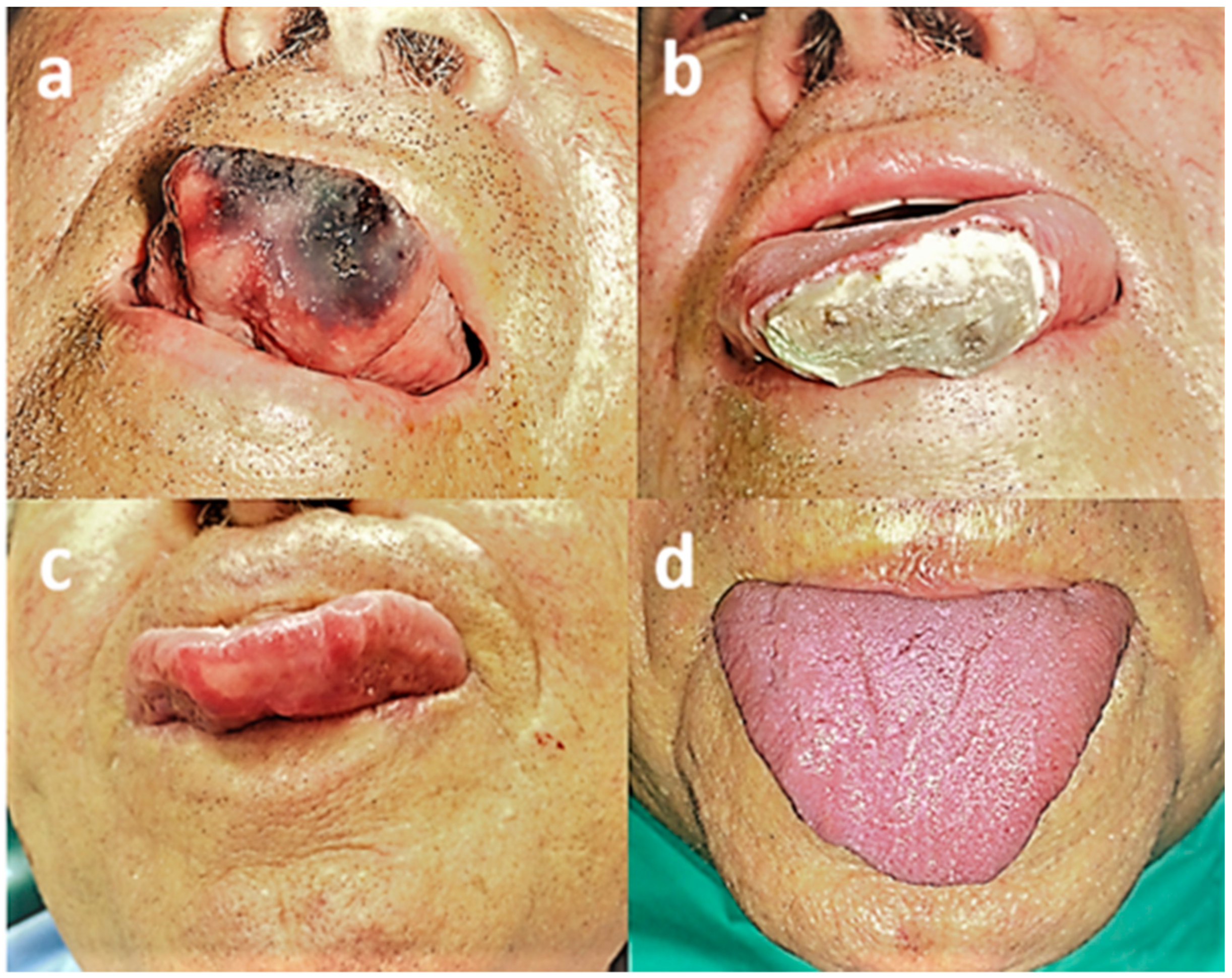 Medicina 56 00254 g004