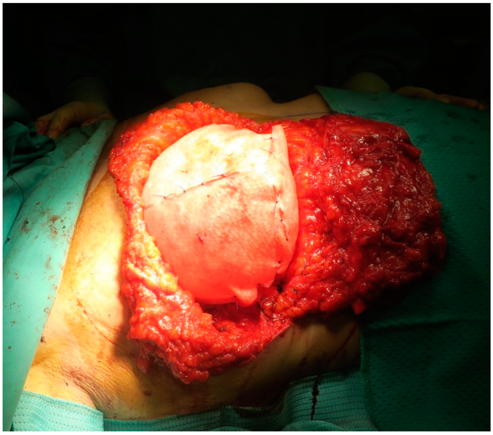 Medicina 56 00256 g002 Medicina 56 00256 g002