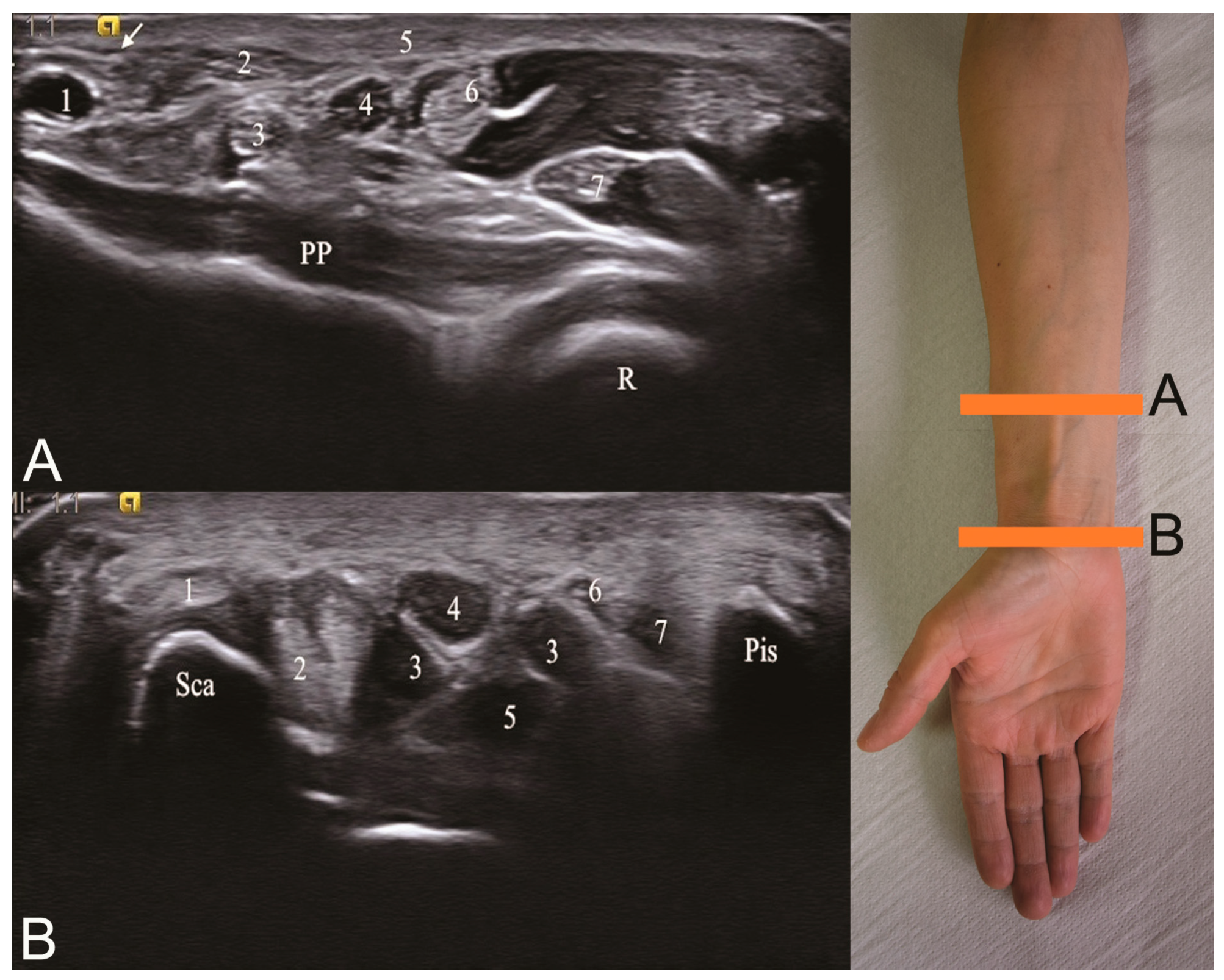 Medicina 56 00279 g001