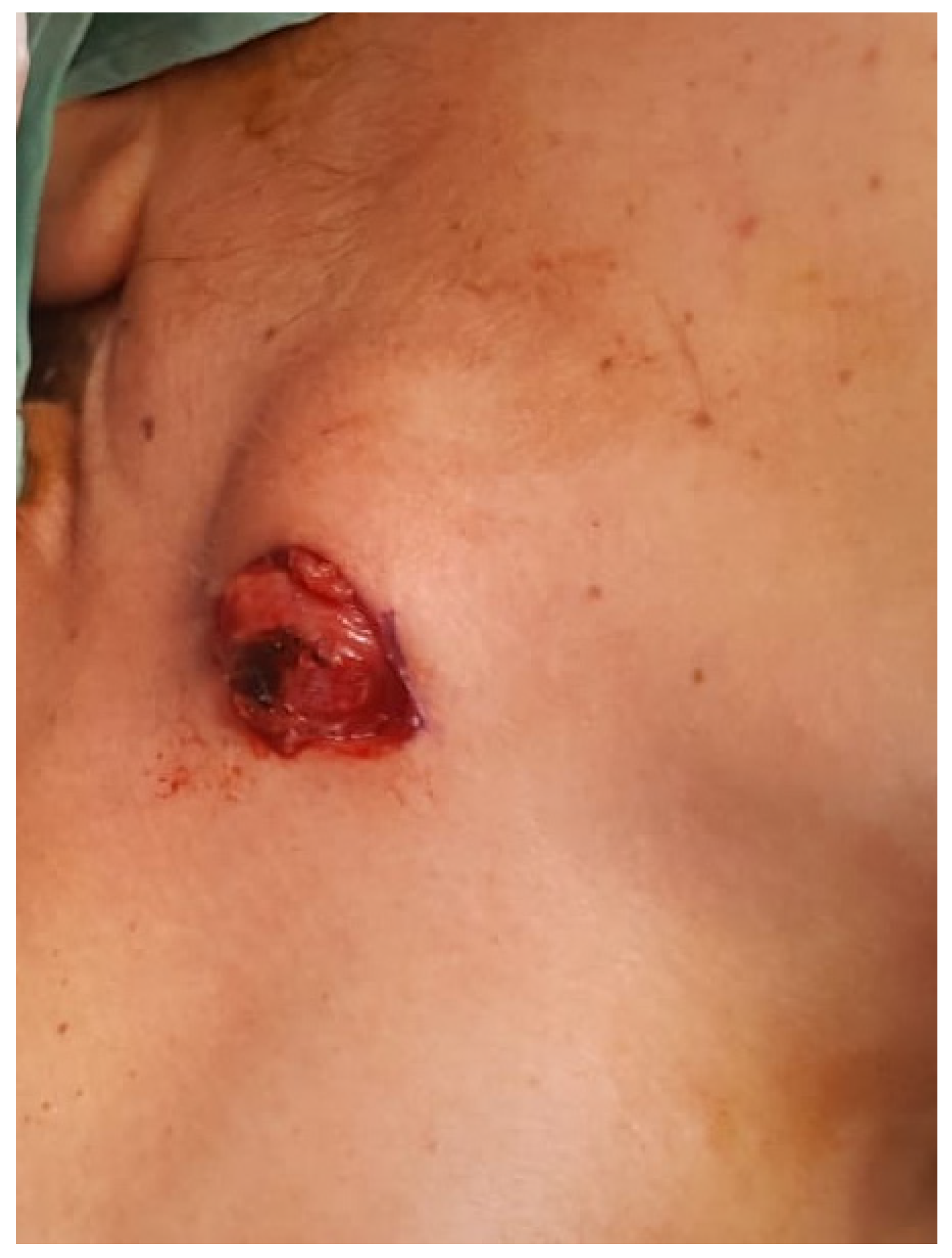 Medicina 56 00283 g002 Medicina 56 00283 g002