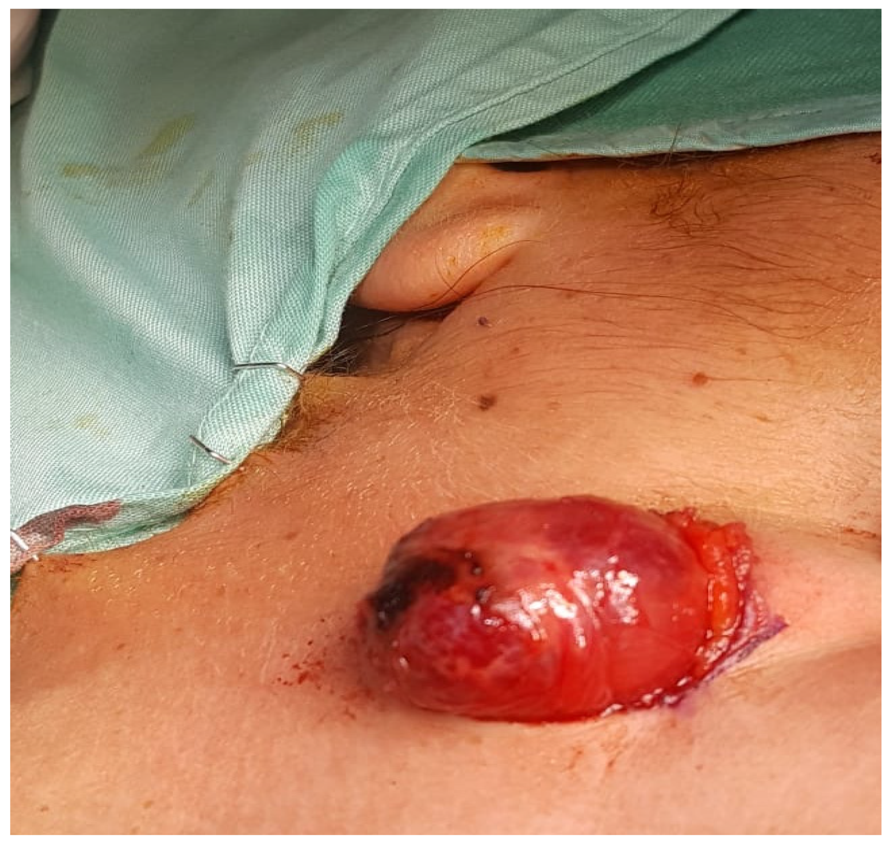 Medicina 56 00283 g003 Medicina 56 00283 g003