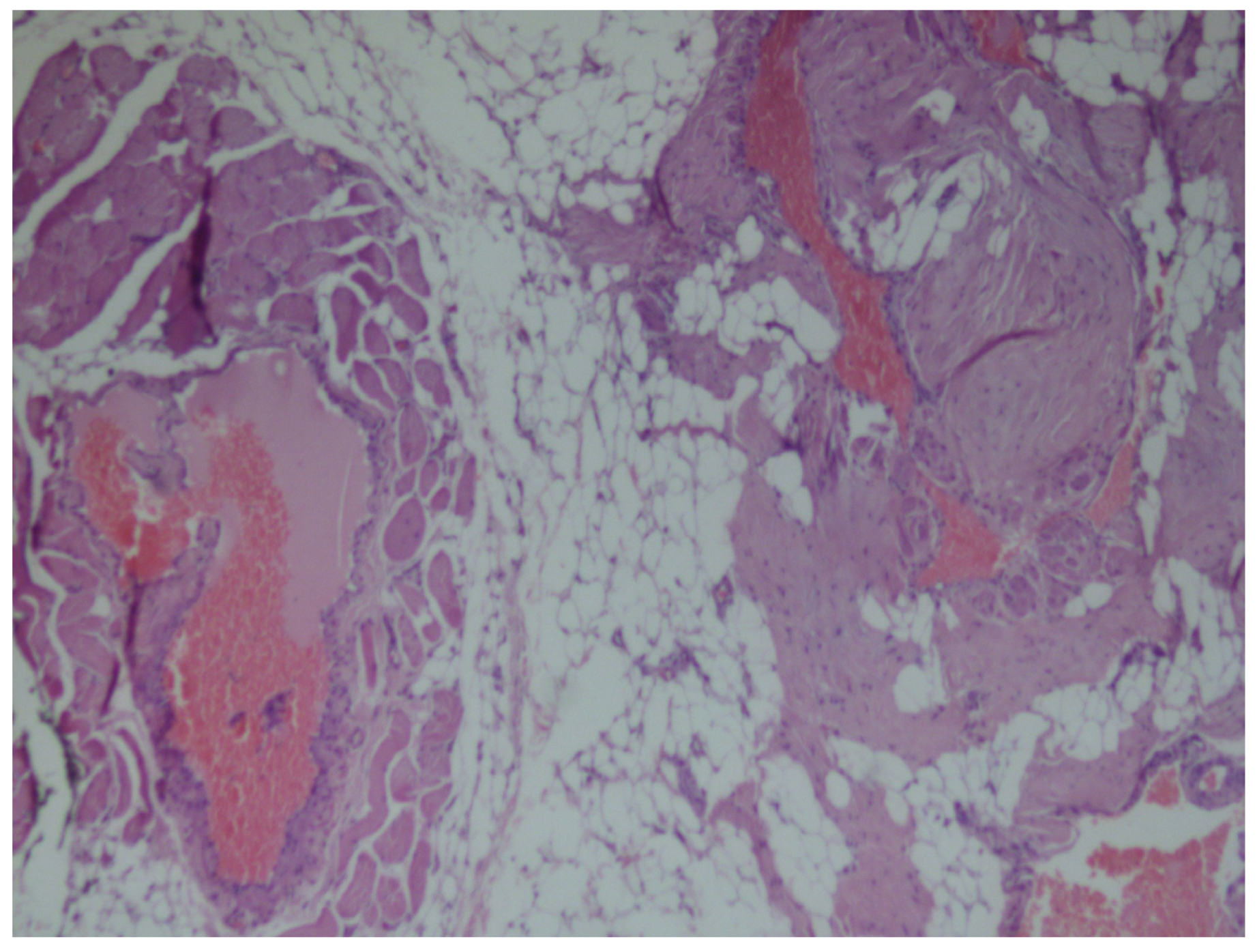 Medicina 56 00283 g004 Medicina 56 00283 g004