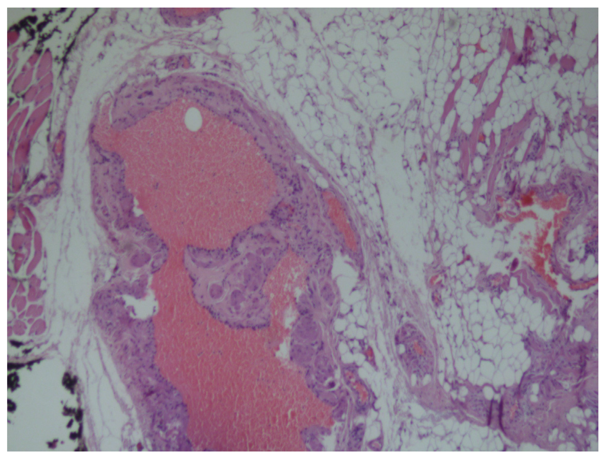 Medicina 56 00283 g005 Medicina 56 00283 g005