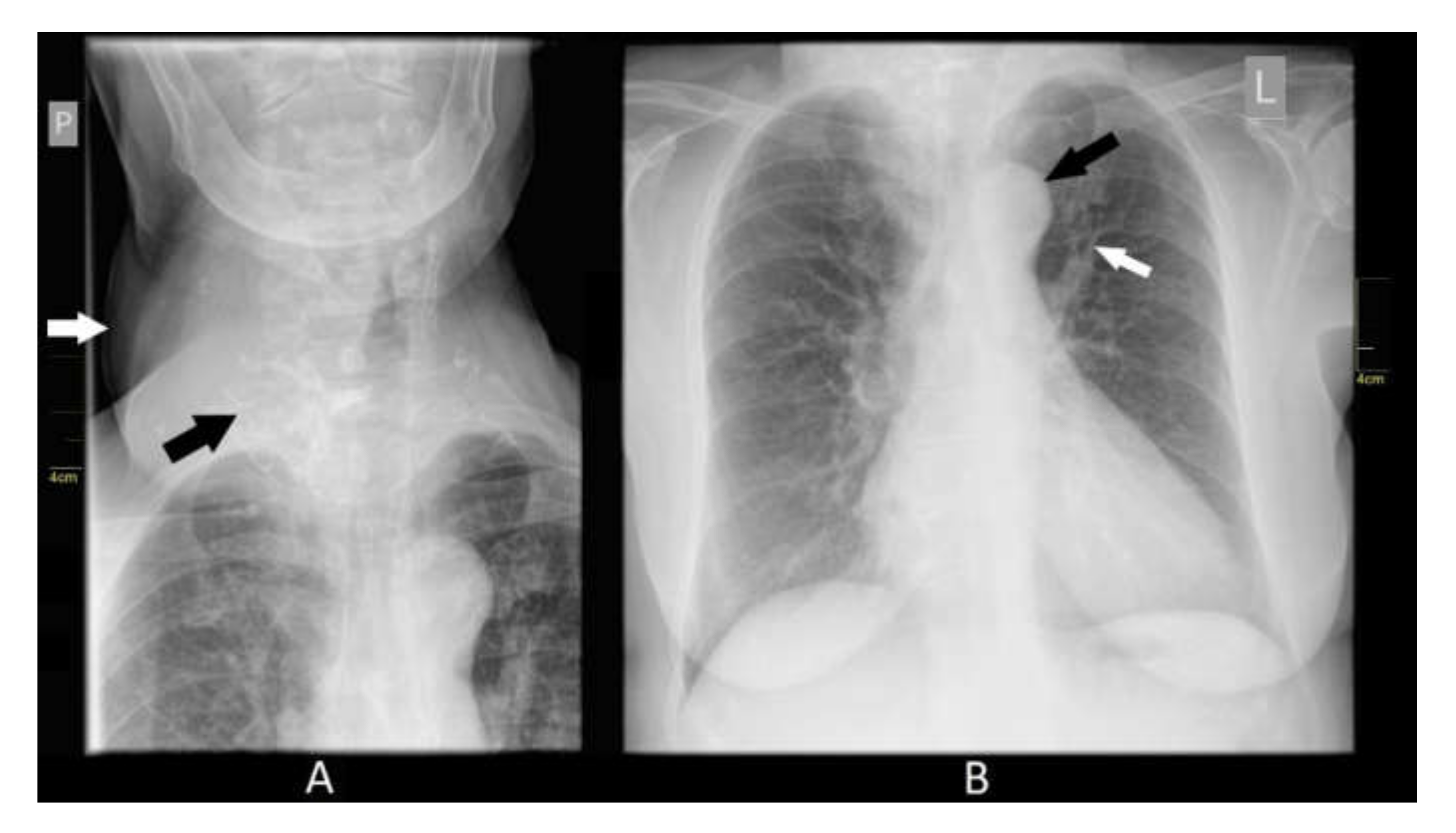 Medicina 56 00290 g003