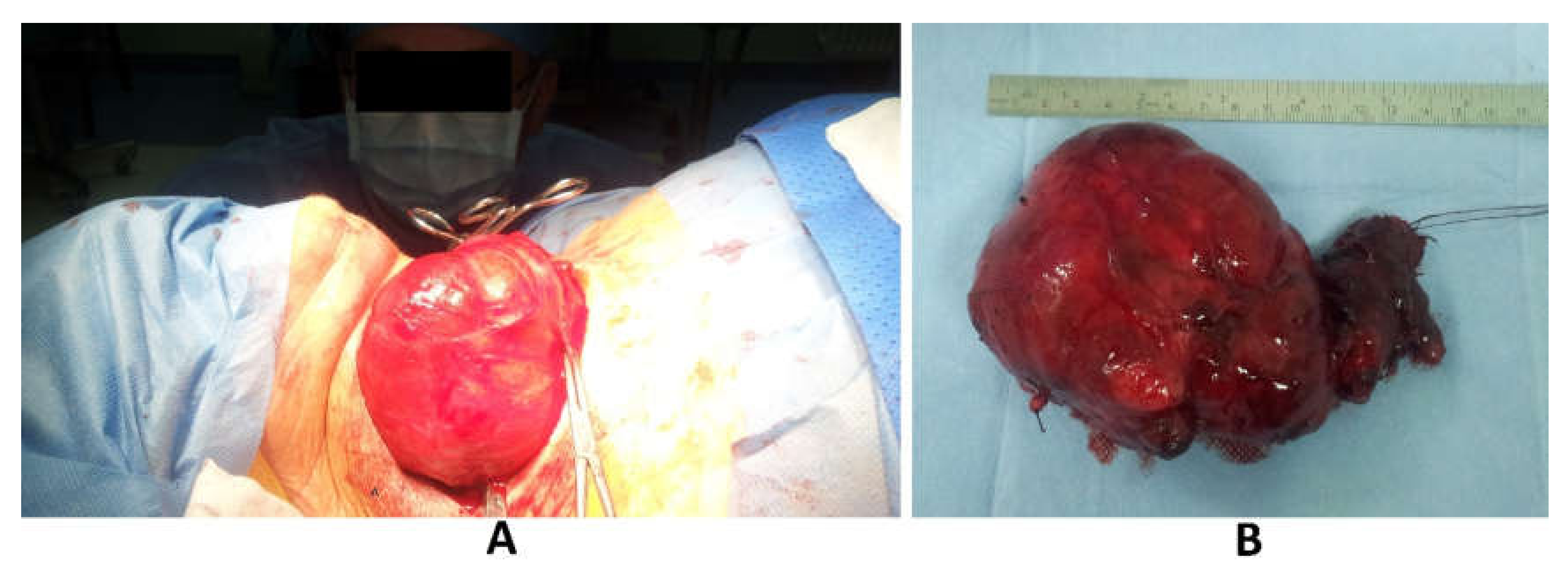 Medicina 56 00290 g004